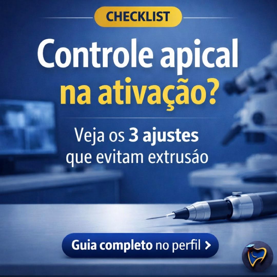 Ativar o irrigante não é apenas aumentar eficiência.
É assumir maior responsabilidade biológica.
Grande parte dos acidentes de irrigação não ocorre pelo hipoclorito de sódio em si,
mas por falhas na condução clínica:
comprimento de trabalho impreciso, ausência de glide path, pressão hidráulica excessiva ou ativação sem controle apical.
A ativação potencializa resultados —
mas não corrige erros prévios.
📖 Neste artigo, discutimos de forma integrada
como comprimento de trabalho, preparo cervical, glide path e posição da ponta ativadora determinam a segurança apical.
👉 Leia o artigo completo no blog EndoToday. Link na Bio
Ativar sem controle não é evolução.
É risco evitável.
#SegurançaApical
#AtivaçãoDoIrrigante
#IrrigaçãoEndodôntica
#RaciocínioClínico
#EndodontiaBaseadaEmEvidências
#EndoToday #endotodayacademy
@abo.rondonia @hdensinosoficial @aorp1946 @apcdararaquara
@thaischriscunha @pascoalinodoc @martinmeirelles @daniedison