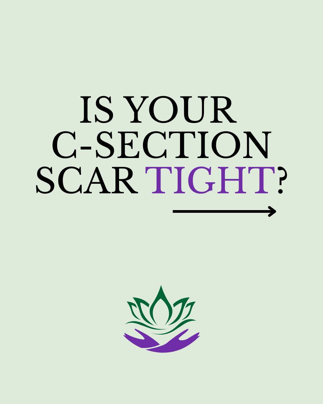 Hi there my lovely ladies 🌸
I’m the founder of Bloom Clinic and Spa and I specialise in medical C-section scar massage. I often meet women who feel "stuck," tight, or numb after surgery. If you feel a pulling sensation or discomfort, please know it doesn't have to stay that way.
I use a clinical approach to help your body heal properly. My treatment works to:
🌸 Soften hard scar tissue.
🌸 Release deep internal tension.
🌸 Flatten the scar "shelf."
You deserve to move freely and feel comfortable in your skin again. 🤍
DM me "HEAL" to start your recovery.