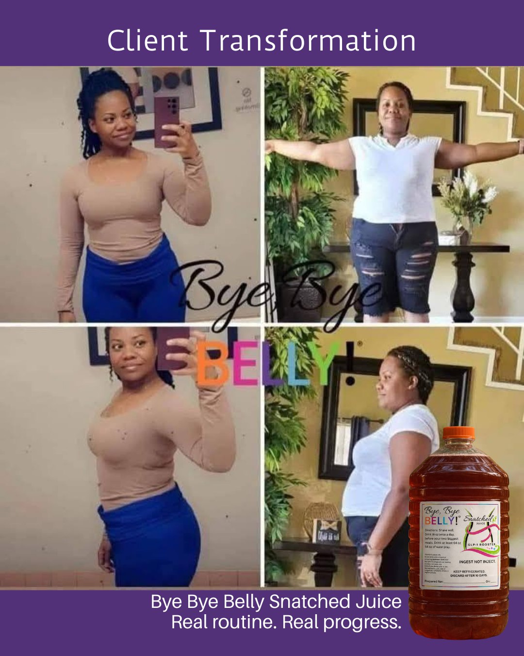 She didn’t come in asking for perfection.
She came in wanting to feel comfortable again.
After the holidays, her body felt off — bloated, heavy, disconnected.
What she needed wasn’t another extreme plan…
She needed support, consistency, and a realistic approach.
That’s what we focus on at Robsie Body Boutique.
✨ Real people
✨ Real progress
✨ Treatments that work with your body
If you’re starting this year wanting results that actually feel sustainable…
📩 DM TRUST to learn how we can support your journey.
📍 Tucker, GA
#RobsieBodyBoutique
#ClientTestimonial
#TuckerGA
#AtlantaWellness
#NonInvasiveBody