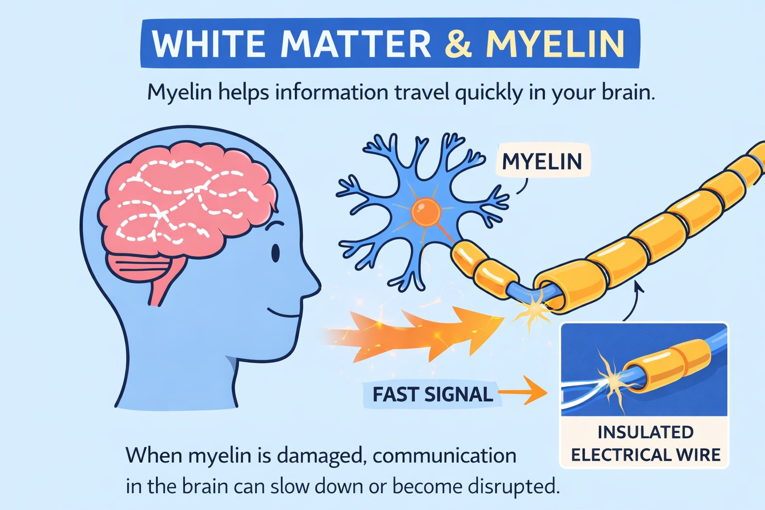 When we talk about brain injury, speed of communication matters. 🧠⚡
Neurons are wrapped in a white matter substance called myelin. It works like insulation around an electrical wire, helping messages travel quickly and smoothly through the brain.
After a brain injury, myelin can be damaged. When this happens, signals may slow down or become disrupted, affecting movement, thinking, memory, or fatigue. Rehabilitation helps the brain find new ways to communicate.
#BrainInjury #WhiteMatter #Myelin #Neuroscience #BrainHealth #NeuroRehab #UnderstandingBrainInjury