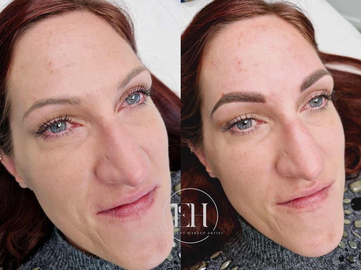 My client previously had microblading done elsewhere, which healed with a blue/grey tone. Laser removal was the only suitable option. Although a small amount of old pigment residue remained after removal, enough had cleared for me to safely create new brows. Here is her final result – fresh, soft and natural.
#ehpermanentmakeup #stalbans #permanentmakeupstalbans #powderbrows #stalbansalon