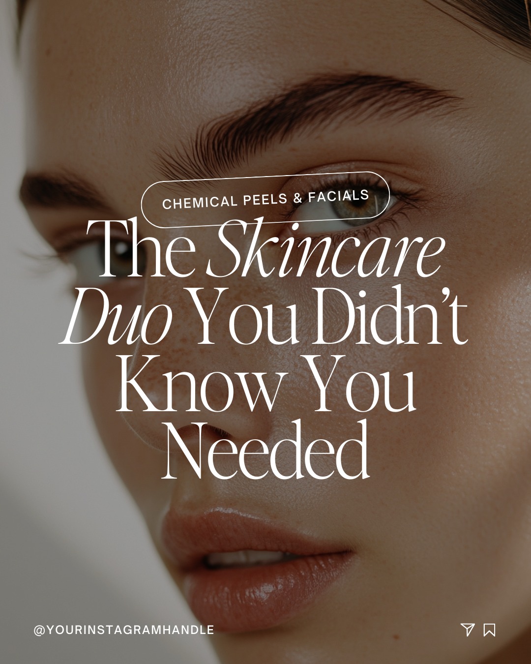 Here’s a skincare secret: chemical peels and facials are a match made in heaven! 🌟
Peels exfoliate and reset your skin, smoothing texture and fading dark spots, while facials hydrate, soothe, and restore balance.
✨Together, they create the perfect harmony—clearing the way for powerful results and leaving your skin radiant, refreshed, and ready to shine.✨
Ready for the ultimate glow-up? Let’s customize a treatment just for you! 💕
✨📲 Call us : 319-939-1824
📍 212 E 4th St, Waterloo, IA 50703
🔗 https://dashboard.boulevard.io/booking/businesses/e42807b0-3d4c-4aba-9313-3910c14faa57/widget#/cart/menu to schedule your appointment today
💻 rejuvenatemedspaia.org
📱RepeatMD: https://rejuvenate.repeatmd.app/signin
#medspa #waterloo #cedarvalley