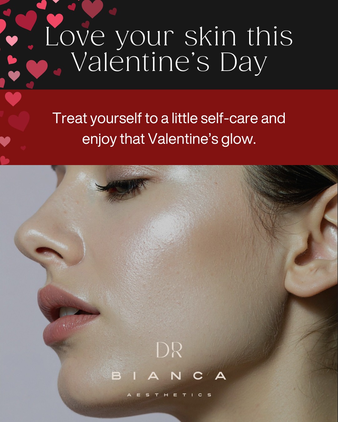 Valentine’s Day is for Self-Care Too♥
Valentine’s Day isn’t just for others - it’s the perfect time to show yourself some love. Treat yourself to a rejuvenating treatment and feel confident, refreshed, and radiant from the inside out. Because self-care is the ultimate act of love.
#ValentinesDay #TreatYourself #SelfLove #DrBianca #AestheticTreatments #GlowUp #LoveYourself #ConfidenceBoost #SelfCareMatters #valentinesselfcaregift