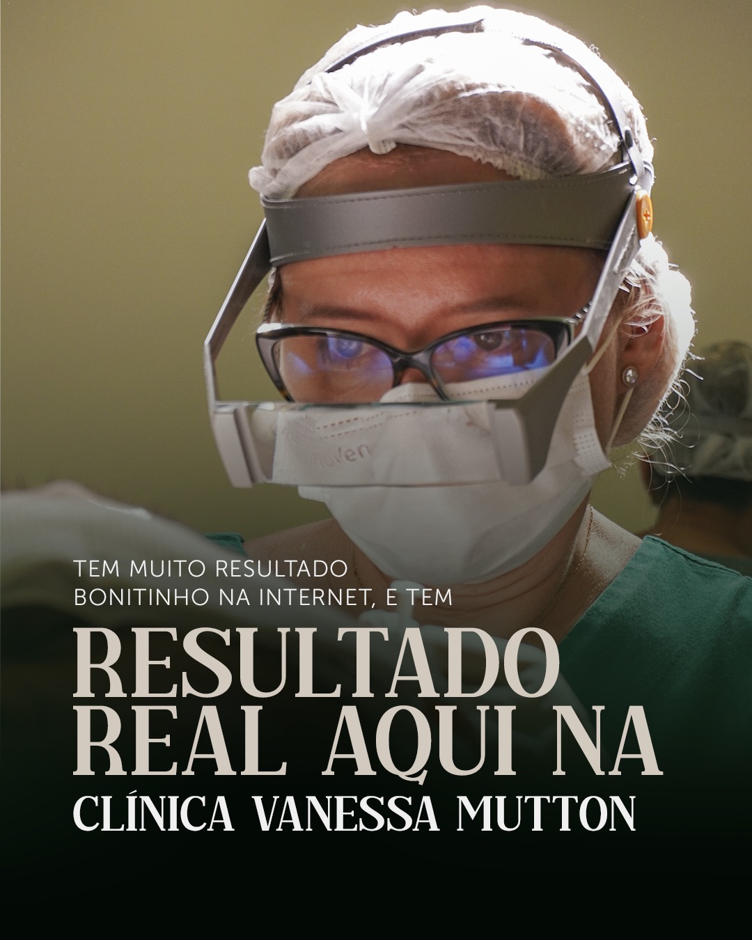 A gente sabe que as redes estão cheias de promessas e antes & depois duvidosos, mas aqui o resultado não precisa de filtro.
Com atendimento médico, exames, tecnologia e um plano personalizado para cada paciente, os resultados aparecem onde realmente importa: no espelho.
Quer ver mudanças reais no seu cabelo?
Comece com um diagnóstico de verdade.
Agende sua avaliação com a Dra. Vanessa Mutton.
#dravanessamutton #sorocaba #transplantecapilar #quedacapilar