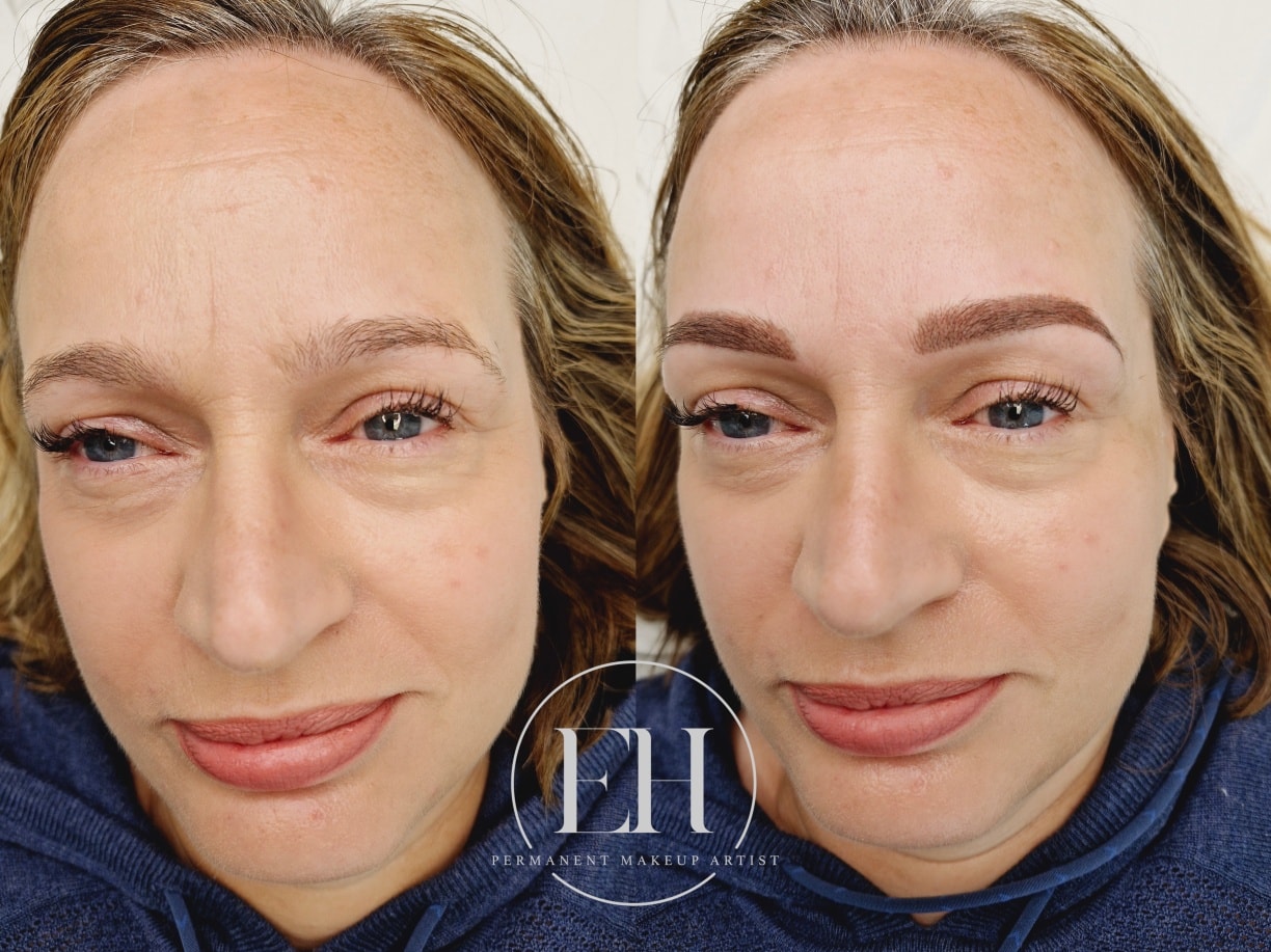 Thinking about summer-ready brows? ✨
Now is the perfect time to start planning your eyebrow transformation.
Permanent makeup is done in 2 sessions — your initial appointment, followed by a touch-up after 8 weeks for the best, long-lasting result.
Smudge-proof, effortless brows all summer long
#permanentmakeup #ehpermanentmakeup #stalbans #powderbrows #herts #naturalbrows