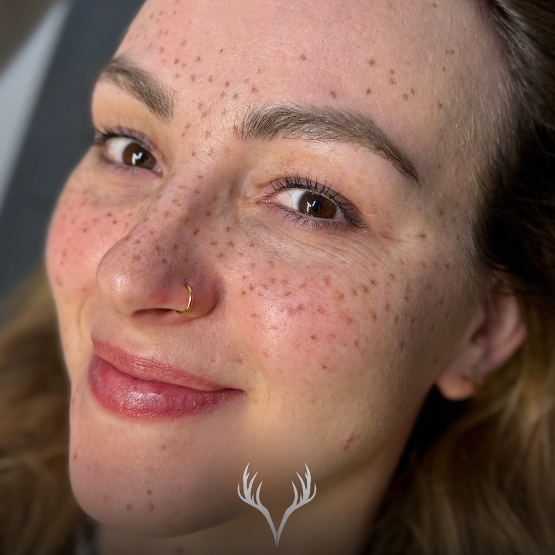 Heavy Freckles 🤎✨
Wir lieben es, wenn es einmal ein bisschen mehr sein darf.
Die einen mögen Freckles ganz soft – wie ein Hauch Sommer.
Und manche wollen, dass man sie sieht. Dass sie rausstechen. Dass der Look Persönlichkeit hat. Und genau das feiern wir: Freckles sind so vielseitig wie ihr.
Von „sun-kissed“ bis „statement“ – wir passen Dichte, Größe und Verteilung immer an dein Gesicht an. Denn Fake Freckles sind nicht einfach nur Punkte, sondern ein kompletter Vibe. 😍
Und by the way: Diese Kundin ist einfach zuckersüß. Wir freuen uns wirklich jedes Mal, wenn sie bei uns im Studio ist – weil sie nicht nur ein wunderschönes Ergebnis trägt, sondern auch diese Energie mitbringt, die einen Tag noch besser macht. 🫶
Team soft freckles oder team heavy freckles? 👀🤎
📍 Beauty Bar Baden – Fake Freckles / PMU
📞 Termine telefonisch oder über unser Online-Buchungstool
#heavyfreckles #fakefreckles #frecklespmu #sommerprossen #pmubaden #permanentmakeupbaden #beautybarbaden #badenbeiwien #statementlook #sun kissed #pmuliebe #beautyconfidence #natürlicherlook #freckleslover #selfcarebaden