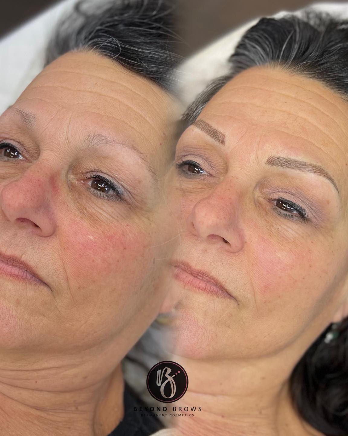 Where we started at 1st session vs where we ended at 2nd session.
She wanted a natural finish with enough color that she could clearly see but without a heavy look.
A combination eyebrow was a perfect choice for her! 🎀
Book an appointment with Marlana by calling the studio or book online ⬇️
📲570-768-6786
💻 www.bbpermanentcosmetics.com
#permanentbrows
#cosmetictattoo
#browshaping
#beyondbrows