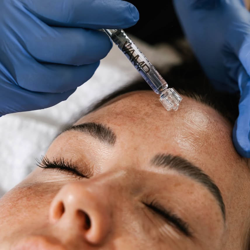 Microneedling - Elevated by Science 🧬
When combined with the VAMP™ booster, DP4 microneedling goes beyond collagen stimulation by delivering a powerful blend of growth factors, peptides, and regenerative ingredients deep into the skin where they can work most effectively. This advanced pairing helps accelerate repair, improve texture, soften fine lines, and restore overall skin quality leaving you with healthier, stronger, more radiant skin.
VAMP stands for:
Vitamins
Amino Acids
Minerals
PDRN - which contains salmon DNA which has 95% similarity to human DNA promoting deep skin repair.
DP4 Microneedling + VAMP™ Feb Promo
Reg $750 - Promo $595
Available until February 28
📞 Call 604-943-9399
📧 reception@viewlaser.com