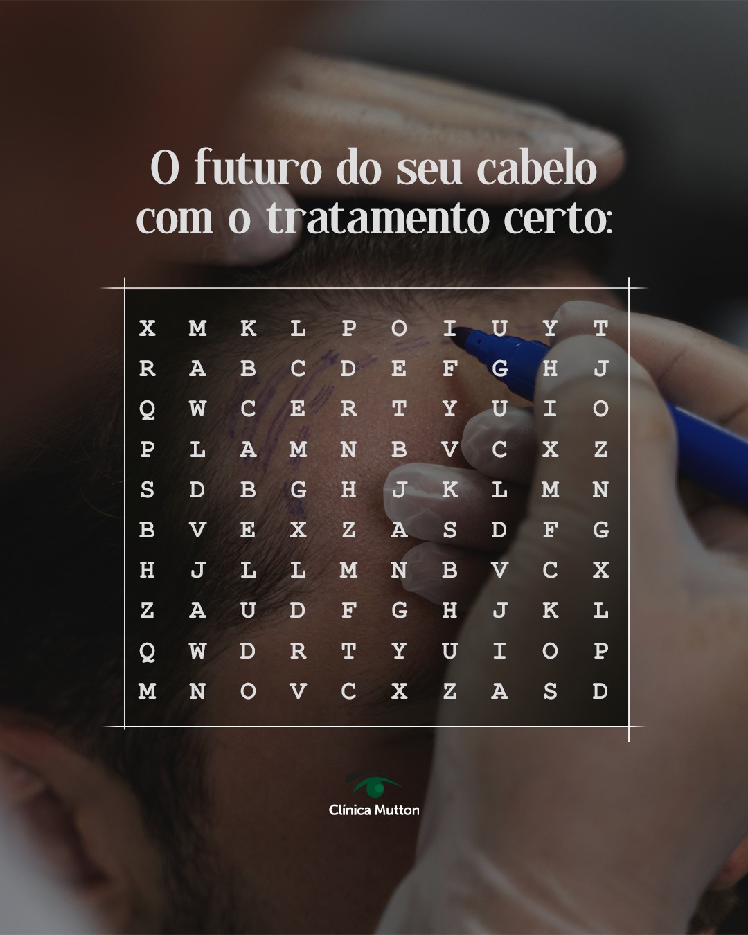 O futuro do seu cabelo pode ser diferente, mais cheio, saudável e sim... cabeludo.
Com o tratamento certo, indicado por quem entende do assunto, é possível controlar a queda e recuperar o volume.
Achou a palavra no caça-palavras? Agora é hora de achar a solução.
Agende sua consulta.
#DraVanessaMutton #sorocaba #transplantecapilar #quedacapilar