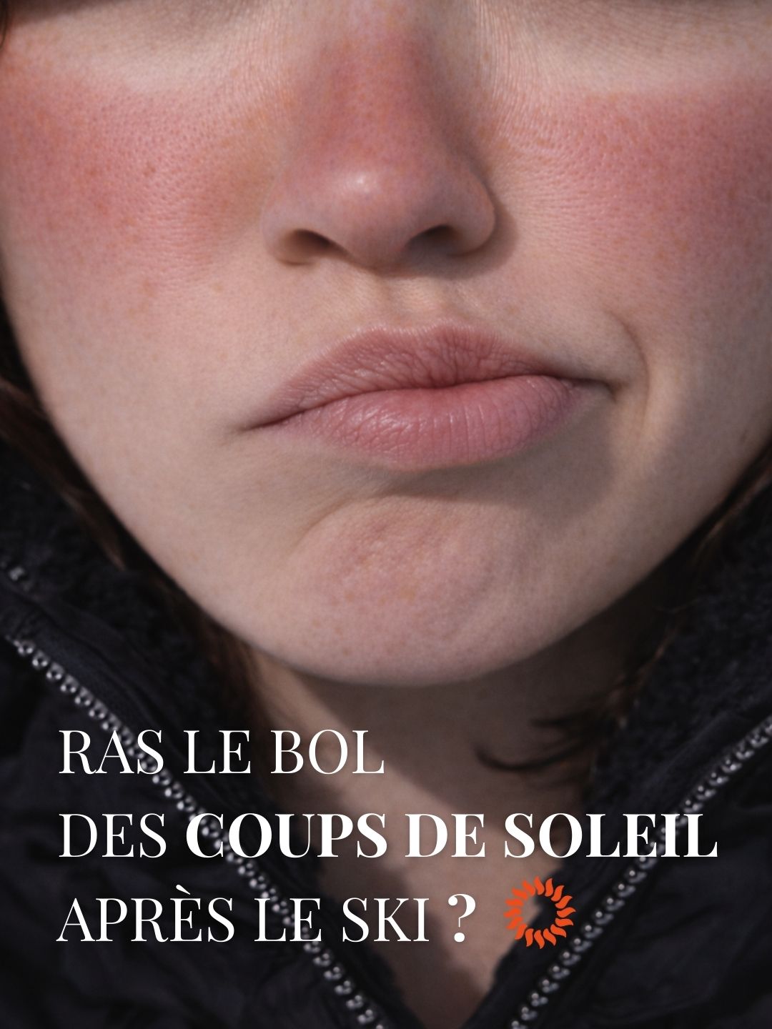 Ras le bol des coups de soleil après le ski ?
À la montagne, l’exposition est plus intense :
• Les UV augmentent avec l’altitude
• La neige réfléchit jusqu’à 80 % des rayons
Résultat : même par temps froid, la peau peut brûler… et marquer.
Un SPF50+ aide à prévenir rougeurs, taches et vieillissement prématuré.
#protectionuv #spf50 #hiverausoleil #montagne #preventionsolaire #peausaine #dermocosmetique #soinsvisage #skincarefrance