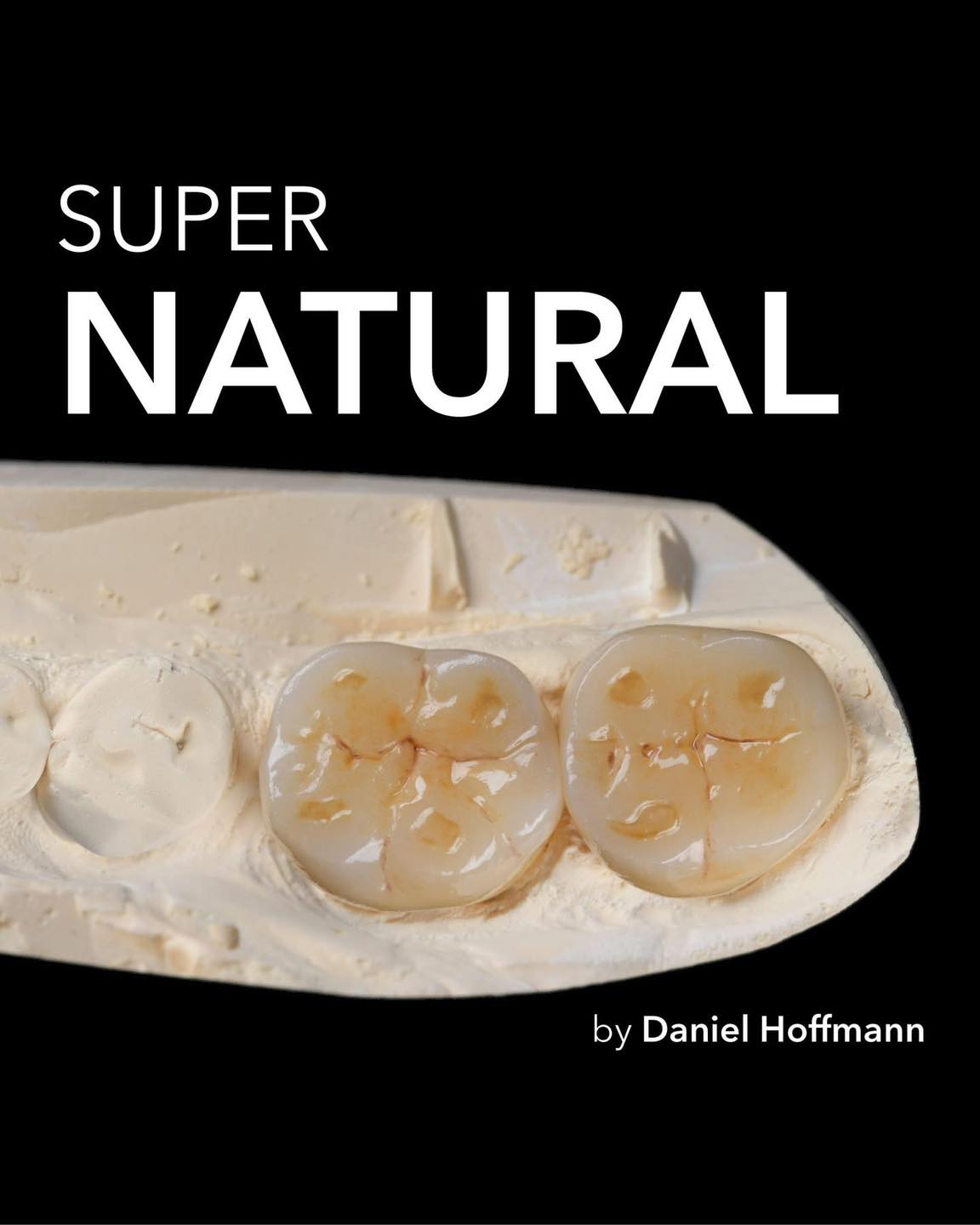 High-tech materials meet true craftsmanship.🤩
Seriously impressive crowns by Daniel Hoffmann - thanks for sharing!👏🏻
@sagemax official
جميع الالوان و المقاسات متاحة! و عروض خاصة بمناسبة شهر رمضان الكريم!
لمزيد من المعلومات و للاستعلام اتصل بنا : 24513870 - 24513874
#sagemax #dentalwork #dentaltechnician #smile #dentistry #zahntechnik #عيد_و_كبريته #زركونيا_ديسك #جودة_تثق_بها #جودة_عالية