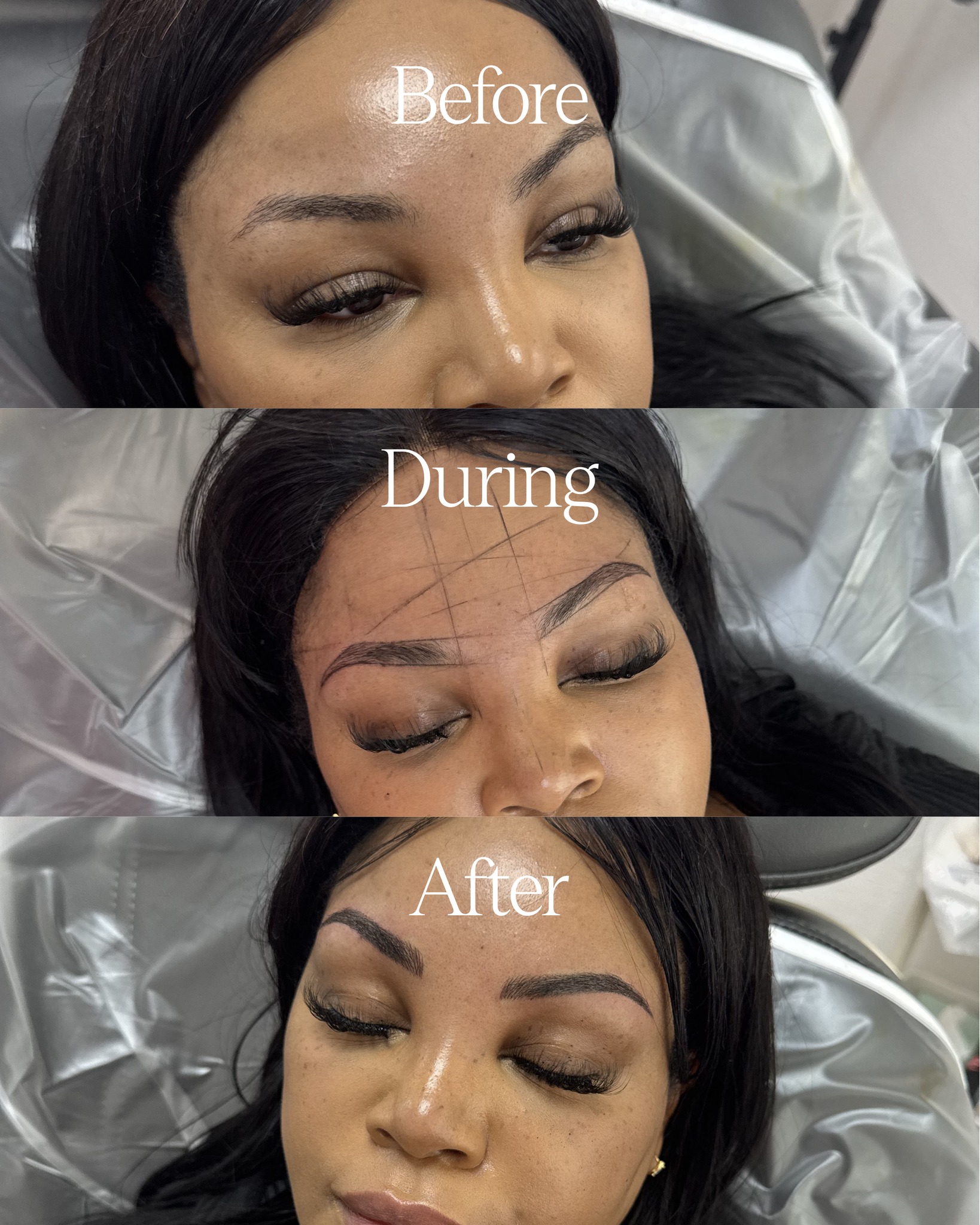 “My brows just won’t grow back.”
I hear this all the time.
Years of over-plucking.
Sparse tails.
Uneven arches.
Gaps that pencil just won’t fix.
This is exactly why I love what I do.
Swipe through:
• Before – natural but lacking structure
• During – precise mapping (this is where the magic really happens)
• After – defined, lifted, balanced brows that frame her whole face
Notice how we didn’t go too thick.
We didn’t over-arch.
We didn’t create blocky fronts.
We created balance.
Mapping is everything. If the structure isn’t right, the result won’t be either.
Permanent makeup isn’t about stamping on a trendy brow — it’s about designing one that fits your bone structure, symmetry and natural growth pattern.
If you’re filling your brows in every day… this might be your sign.
Comment “BROW” if you want to know more about the process 🤍
Or book via the link in my bio.
#PMUBrows #BrowMapping #UKPMU #SoftGlamBrows #BrowTransformation #PermanentMakeupUK