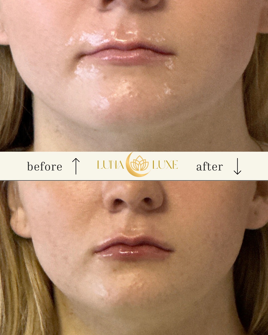 ‼💋 More of some B&A lips