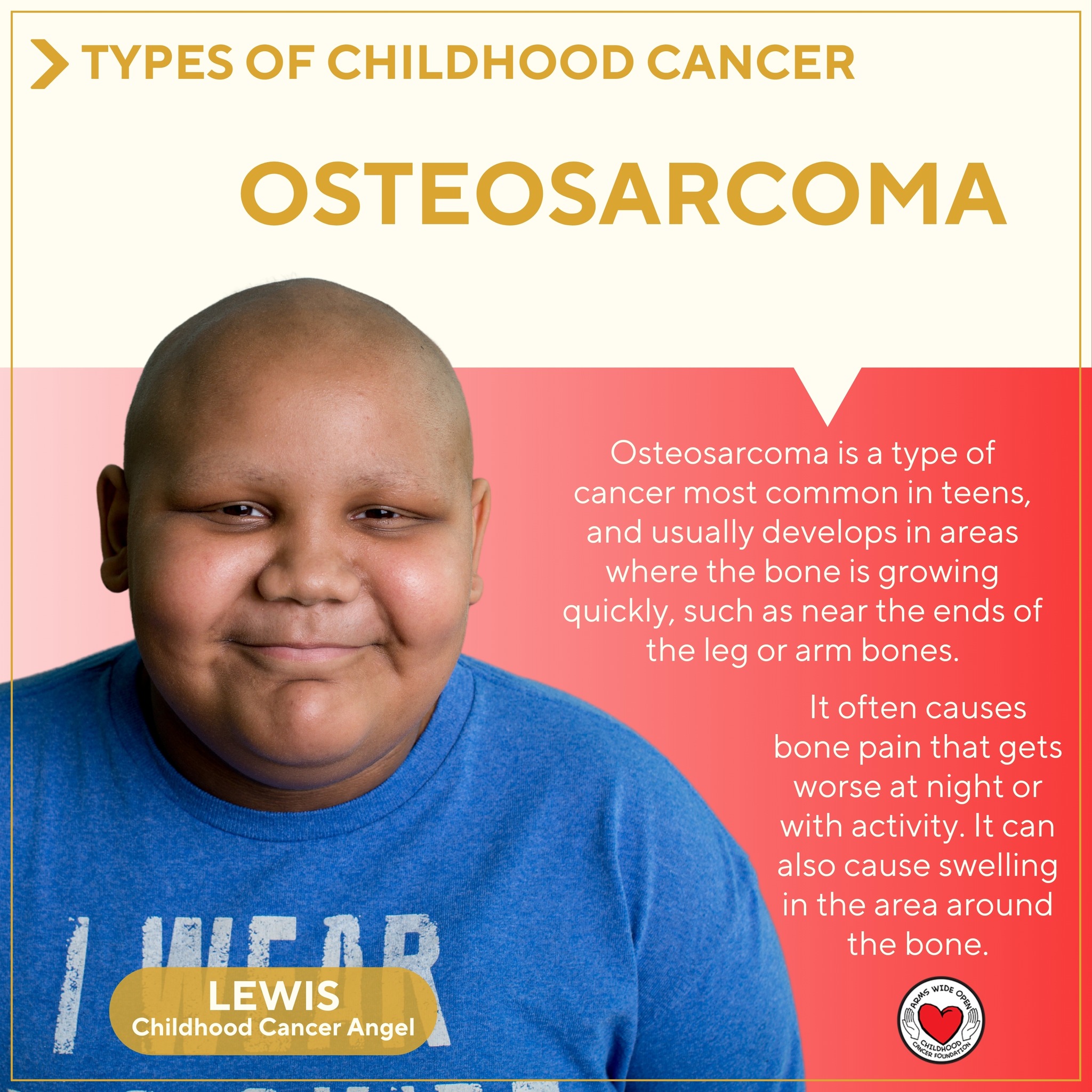 Did you know? There are many different types of childhood cancer, some more common than others.
Osteosarcoma is a type of cancer most common in teens, and usually develops in areas where the bone is growing quickly, such as near the ends of the leg or arm bones.
It often causes bone pain that gets worse at night or with activity. It can also cause swelling in the area around the bone.
To learn more about the many types of childhood cancer, visit:
https://www.thetruth365.org/the-truth-365
Pictured is childhood cancer angel, Lewis 🎗️