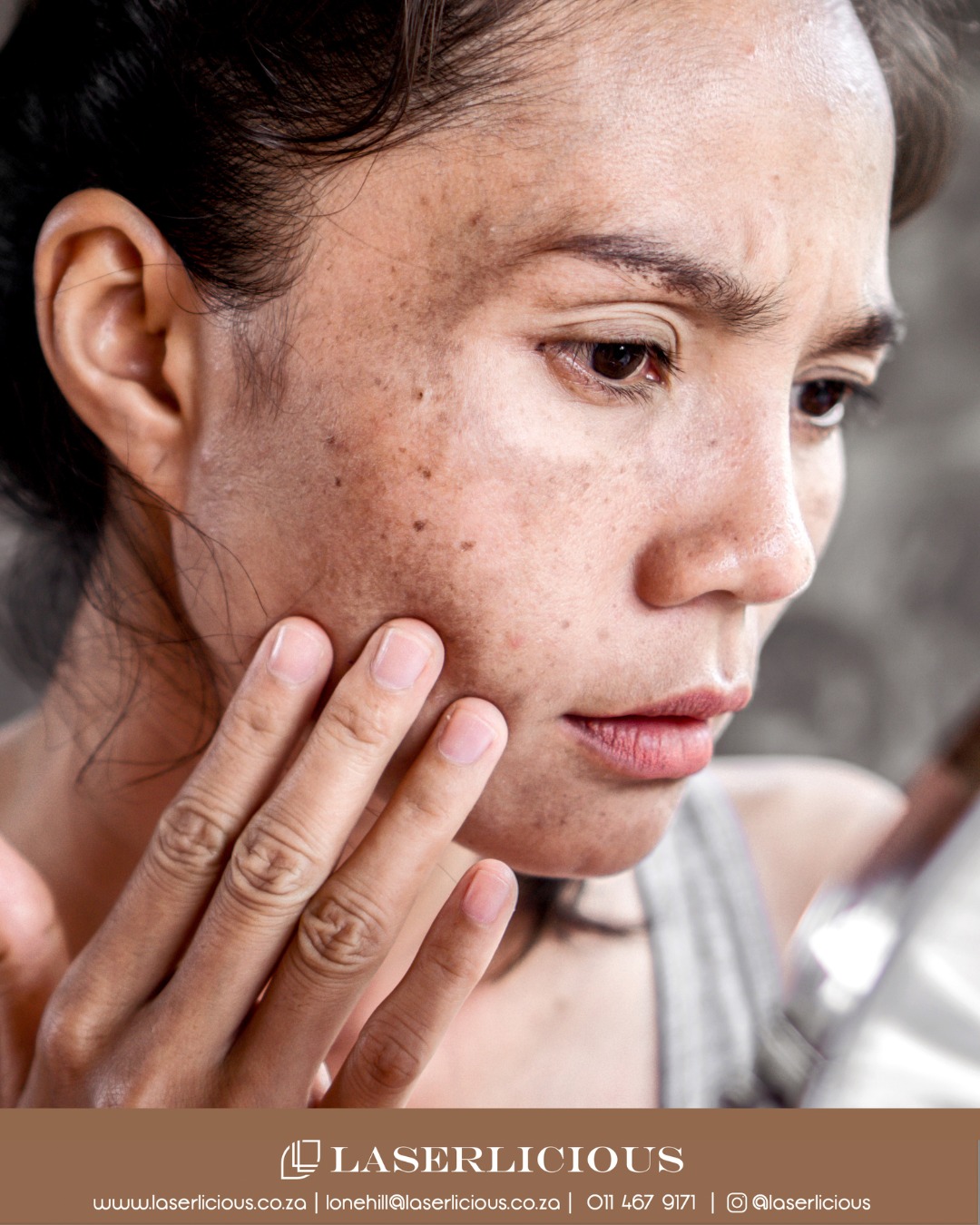 Noticing uneven tone or sun damage after summer? 🌞
Chemical peels and microneedling help improve pigmentation, refine texture, and restore brightness - making autumn the ideal time to correct and renew your skin safely.
📞 Call Laserlicious on 011 467 9171 / WhatsApp 083 490 9524 / info@laserlicious.co.za to make a booking today.
#laserlicious #pigmentation #skintreatments