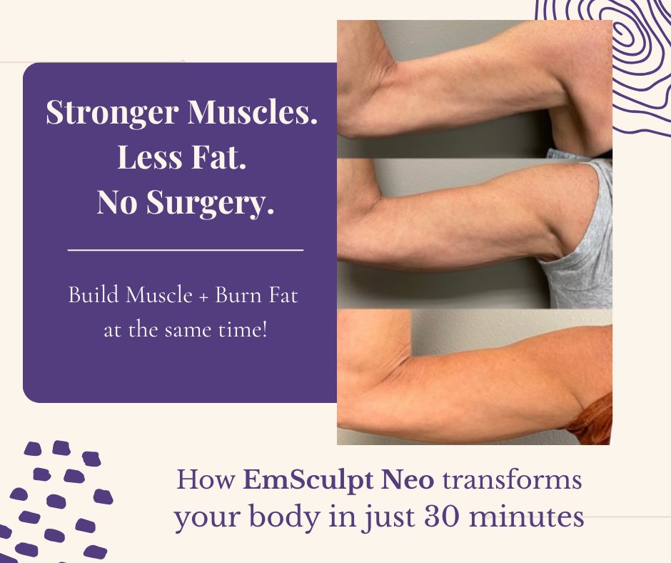 Stronger muscles + less fat — without surgery.
EmSculpt Neo is one of our favorite body contouring treatments because it does something most devices can't:
✨ Builds muscle�✨ Burns fat�✨ Improves definition
In just 30 minutes, the device creates thousands of muscle contractions while radiofrequency heat targets stubborn fat.
Most clients complete a series of 4 treatments for optimal results.
Ready to sculpt your core, lift your glutes, or strengthen your arms?💪🏻
📞 Call or message us to schedule your consultation.
✨📲 Call us : 319-939-1824
📍 212 E 4th St, Waterloo, IA 50703
🔗 https://dashboard.boulevard.io/booking/businesses/e42807b0-3d4c-4aba-9313-3910c14faa57/widget#/cart/menu to schedule your appointment today
💻 rejuvenatemedspaia.org
📱RepeatMD: https://rejuvenate.repeatmd.app/signin
#medspa #waterloo #cedarvalley #iowa #emsculptneo #rejuvenatemedspa