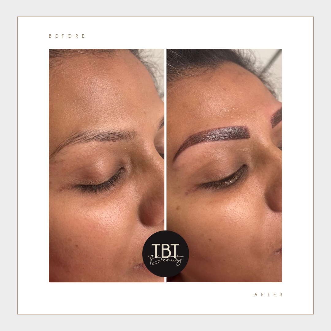 Brows aren’t just hairs—they’re the frame to your face. Transform yours from sparse to flawless.✨💖
📅 Book your eyebrow tattoo today and wake up brow-ready!
https://www.tbtbeauty.com.au/cosmetic-tattooing
#TBTBeauty #EyebrowTattoo #FlawlessBrows #BrowTransformation #CosmeticTattoo #PermanentMakeup #BeautyGlow #BrowGoals #BrisbaneBeauty