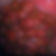 **Possibly sensitive content**
What in the world could this be? Leave your best guess in the comments!
#veterinarycare #veterinarymedicine #tacomaequinehospital #tacomaequine #vetlife #vetmed #horses #horse #horsevet #vet