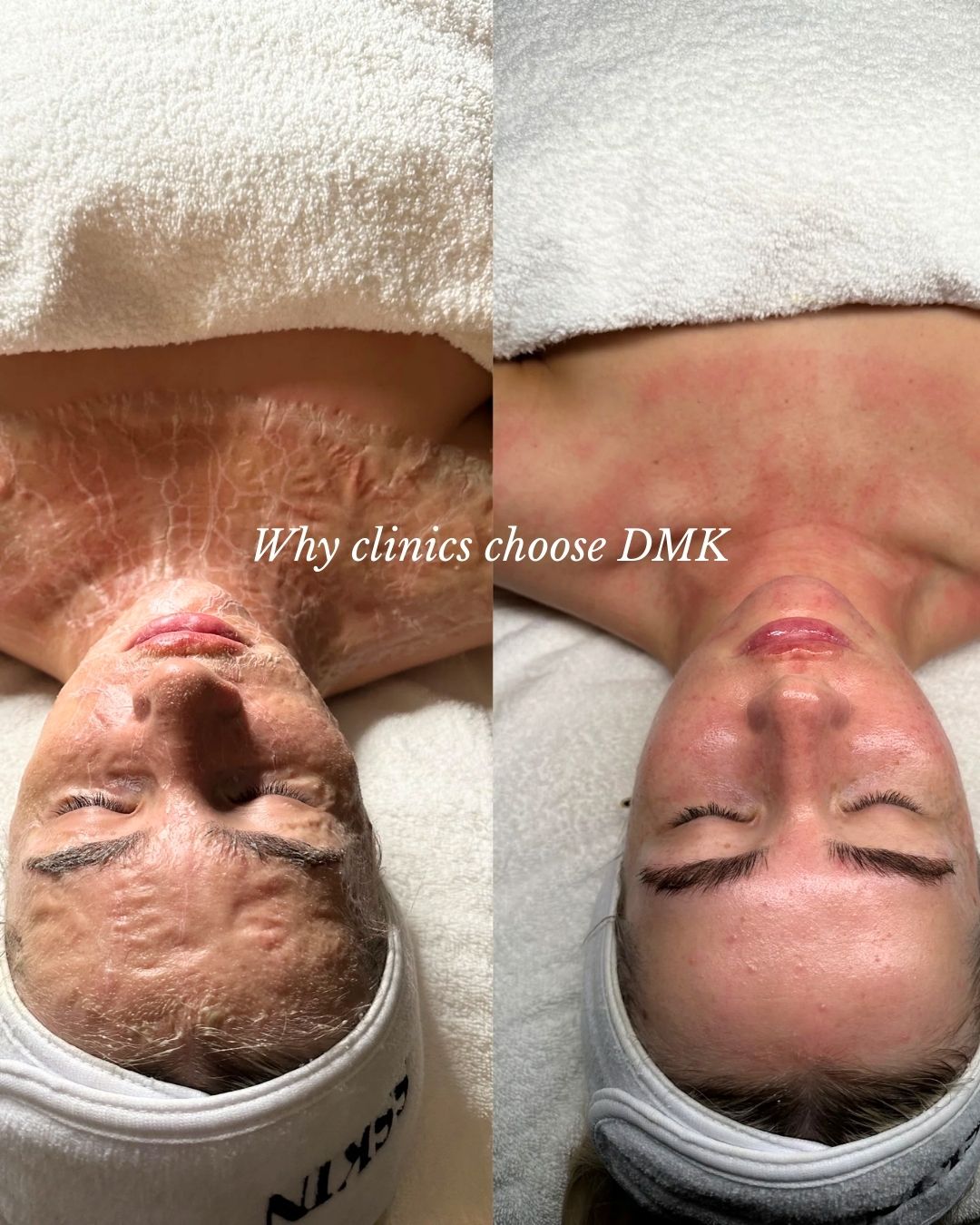 DMK provides clinics with treatments designed for real skin change.
