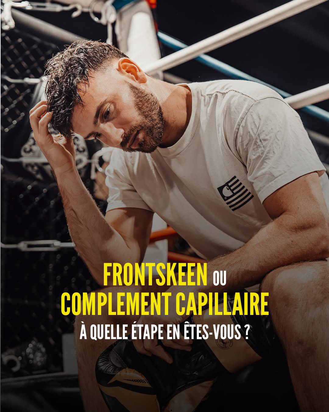 FRONTSKEEN ou Complément Capillaire : quelle solution pour votre client ?
👉 FRONTSKEEN
Idéal pour une perte débutante à modérée, localisée à l’avant : golfes, ligne frontale qui recule, manque de densité sur le devant.
Objectif : redessiner une ligne frontale naturelle avec précision, sans couvrir toute la zone supérieure.
👉 Complément capillaire
La solution adaptée lorsque la perte est plus avancée ou étendue : tonsure, sommet clairsemé, manque global de densité.
Objectif : recréer une densité homogène et un résultat naturel au quotidien.
Chez byTun , nous vous accompagnons avec des solutions professionnelles en compléments capillaires et des produits reconnus comme Hairskeen.
#HairSystemPro #FrontSkeen #Hairskeen #ComplementCapillaire #bytunshop #HairReplacement #MensHairSystem #byTun