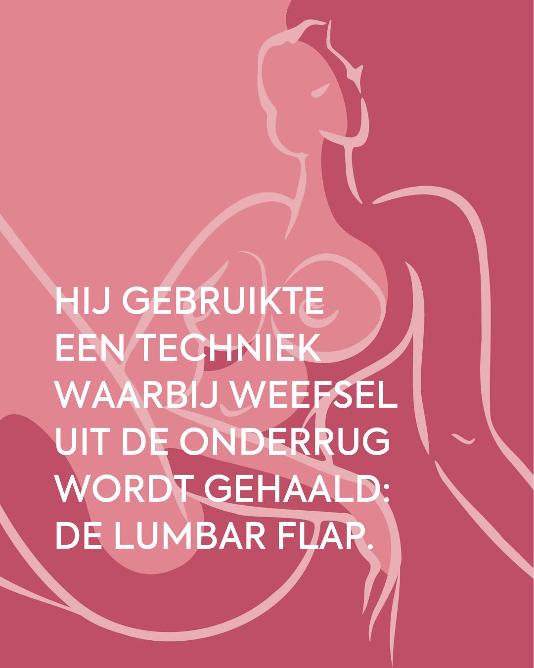 Uiteindelijk heb ik een second opinion gehad in Gent. De plastisch chirurg daar had ik gezien in een documentaire. Hij gebruikte voor borstreconstructies een techniek waarbij weefsel uit de onderrug wordt gehaald: de lumbar flap.
Lees het hele verhaal op onze blog.
https://www.allemooieborsten.nl/post/kiezen-voor-reconstructie-met-eigen-weefsel
🧡
#allemooieborsten #borstkanker #keuzevrijheid #borstreconstructie #lumbarflap