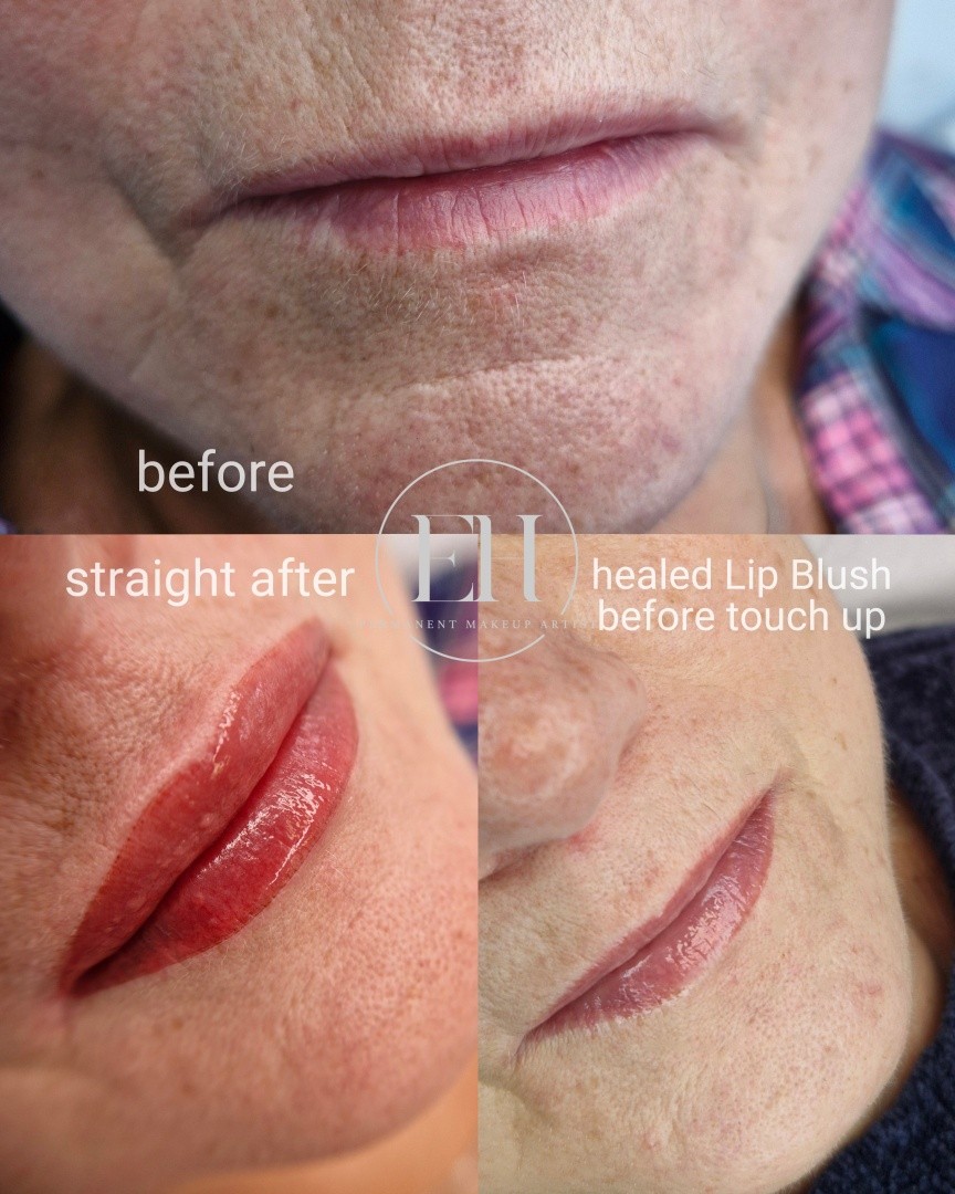 It’s so important to understand that what you see immediately after the procedure is NOT the final result.
Right after Lip Blush, lips can look much brighter and more intense — this is completely normal.
But once healed… that’s where the magic happens ✨
Weeks later, the colour softens beautifully into a natural, subtle enhancement.
In this case, my client wanted something very soft — no strong lipstick effect. So I custom-mixed several pigments to create a delicate, natural shade that simply restores what time has taken away.
✔️ Lip borders are now defined again
✔️ Colour is even and fresh
✔️ Lips look healthy and youthful
Now? All she needs is a touch of lip gloss 💫
And at her touch-up appointment, we refined everything to make them even more perfect.
This is why healed results matter… because that’s what you’ll be living with every day. #lipblush #stalbanspermanentmakeup #lips #ehpermanentmakeup #lipblushstalbans