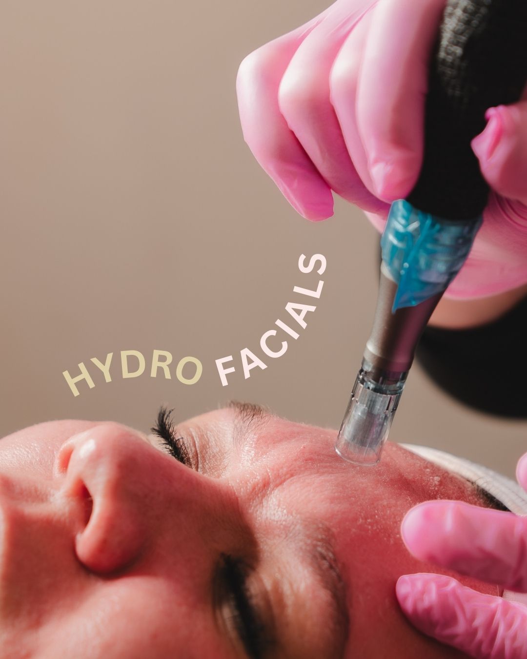 Ready for your best skin yet? ✨
Our Hydro Facial combines advanced technologies to cleanse, lift, tighten and deeply hydrate - all in one treatment.
Instant glow. Zero downtime. Real results. 💧
Your skin deserves more than just a basic facial.
For more information drop us a DM or visit our website - link in bio.
#hydrofacial #beauty #facials #cheshire #facial