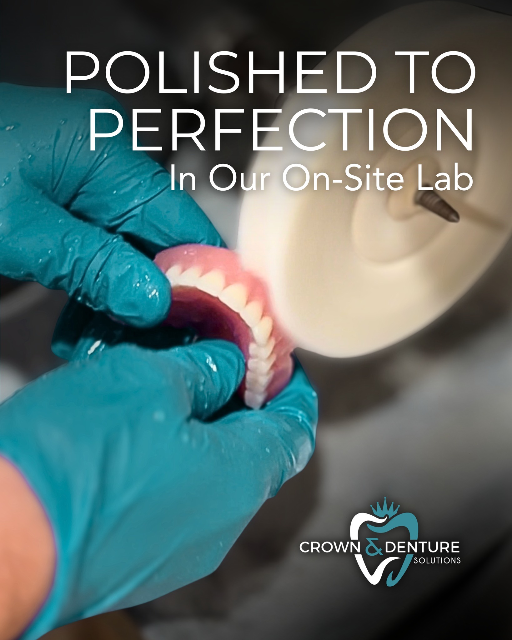 There’s a lot more that goes into your smile than most people realize ✨
Every denture we create is carefully shaped, adjusted, and polished by hand to make sure it looks natural, feels smooth, and fits just right. That final polish isn’t just for looks… it’s what helps with comfort, function, and confidence every single day.
Because we have an on-site denture lab, we’re able to control every step of the process and move faster without sacrificing quality. That’s how we’re able to offer Teeth in a Day for many patients, so you can walk in and leave with a brand new smile the same day.
It’s not rushed. It’s refined. Crafted with care, right here in our office.
📞 Call 318-232-4404 to schedule your free X-ray & exam and see how easy restoring your smile can be.
#DenturesBossierCity #TeethInADay #CustomDentures #SameDayDentures #SmileWithConfidence