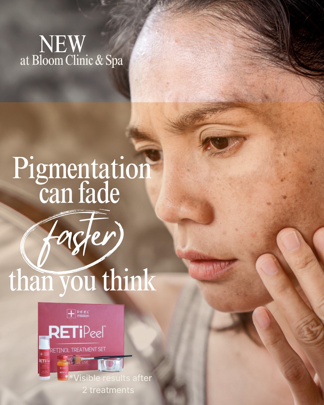 Hi there, lovely ladies 🌸
Are you tired of using heavy makeup to hide dark spots on your face? It feels so unfair when you try every cream, but the "patchy" skin just won’t go away. I know how it feels to want a clear, fresh face without needing to hide.
Most shop creams stay on the surface and don't reach the root of the problem. Your skin needs a deeper clean to truly fade those marks.
Our new RetiPeel is a powerful treatment that works fast:
🌸 Fades dark marks and sun spots.
🌸 Visible changes from just 2 treatments.
🌸 Clears and brightens your whole face.
You deserve to feel bright and happy in your own skin! 🤍
DM me "GLOW" to start your journey.