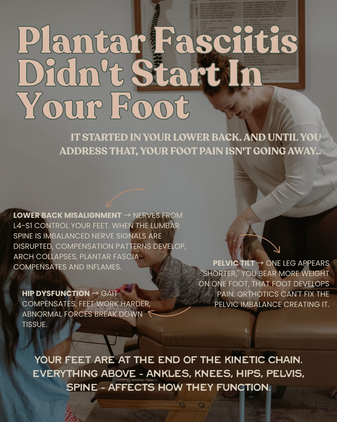 You might be thinking that plantar fascitis is just a foot issue, but did you know that your plantar fasciitis didn't start in your foot? It started in your lower back.
You've tried orthotics, better shoes, stretching, foot massages, rest.
Nothing lasts.
Here's why: You're treating the symptom (foot), not the root cause (spinal compensation).
Your feet are at the END of the kinetic chain. Everything above - ankles, knees, hips, pelvis, spine - affects how they function.
The compensation cascade:
Lower back misalignment â Nerves from L4-S1 control your feet. When lumbar spine is misaligned, nerve signals are disrupted, muscle imbalances develop, arch collapses, plantar fascia compensates and inflames.
Pelvic tilt â One leg appears "shorter," you bear more weight on one foot, that foot develops pain. Orthotics can't fix the pelvic imbalance creating it.
Hip dysfunction â Gait compensates, feet work harder, abnormal forces break down tissue.
Knee issues â Altered walking mechanics, feet bear weight abnormally, chronic stress.
Your foot is just the last domino to fall.
Why treating just the foot doesn't work?
Orthotics support the arch but don't fix why it's collapsing (nerve interference).
Better shoes cushion but don't address compensation pattern.
Stretching provides temporary relief but spine keeps pulling it back.
How chiropractic addresses root cause:
â Lower back adjustments restore nerve flow to feet
â Sacral/pelvic alignment eliminates leg length discrepancy
â Hip adjustments restore proper gait
â Full kinetic chain assessment identifies where compensation started
When we fix the pattern UP THE CHAIN, foot pain resolves DOWN THE CHAIN.
Stop focusing on stretching and rolling out your foot. It's time to address the body as a whole.
.
.
.
#wildbloomchiro #gallatintn #sumnercounty #plantarfasciitis #health #chiropractic #wellness
