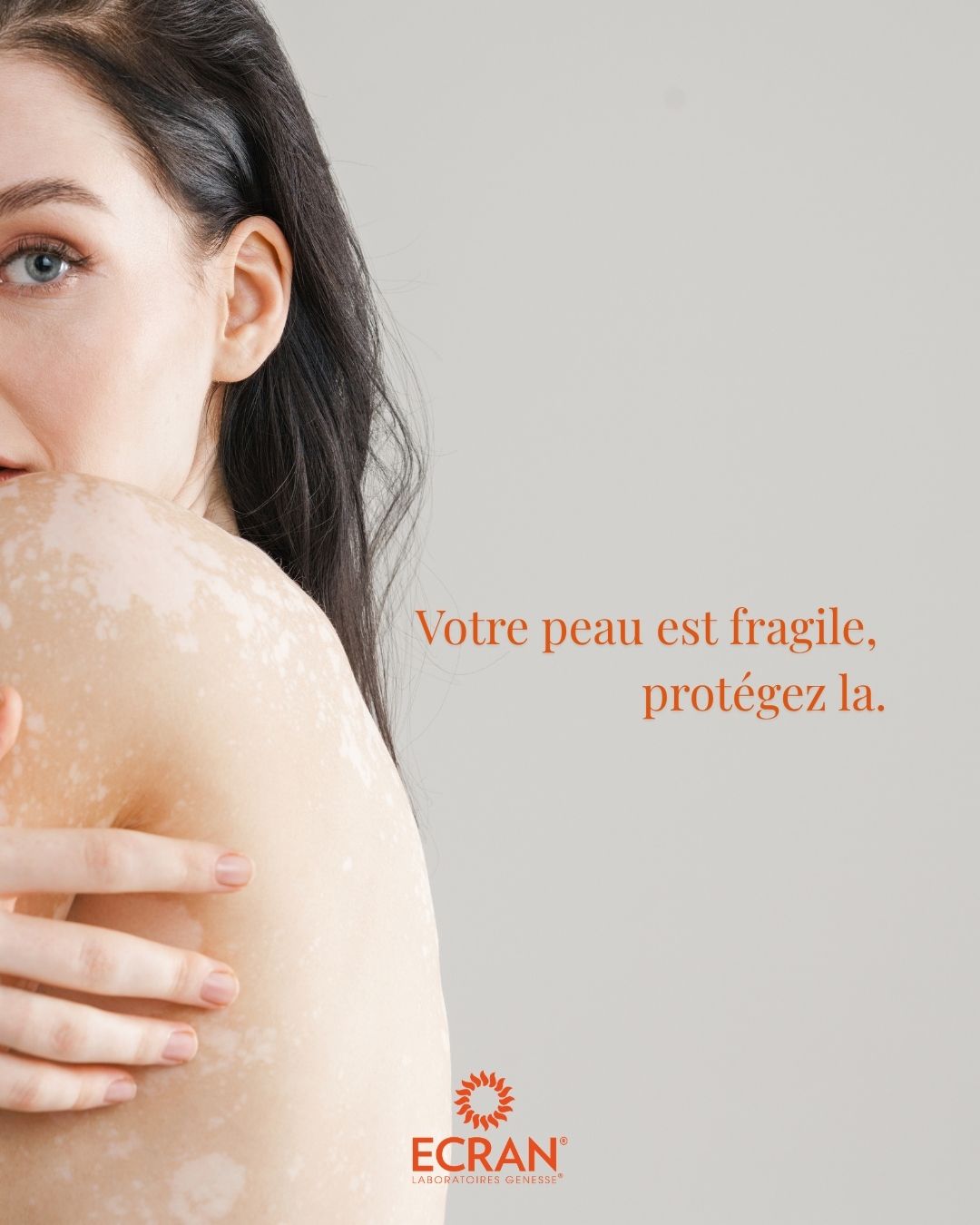 Protégez votre peau avec la crème solaire ECRAN®, enrichie en vitEox80® pour renforcer les défenses antioxydantes naturelles de votre peau. ☀️
#protectionuv #spf #preventionsolaire #skincarefrance #conseilbeauté #crèmesolaire #ECRAN