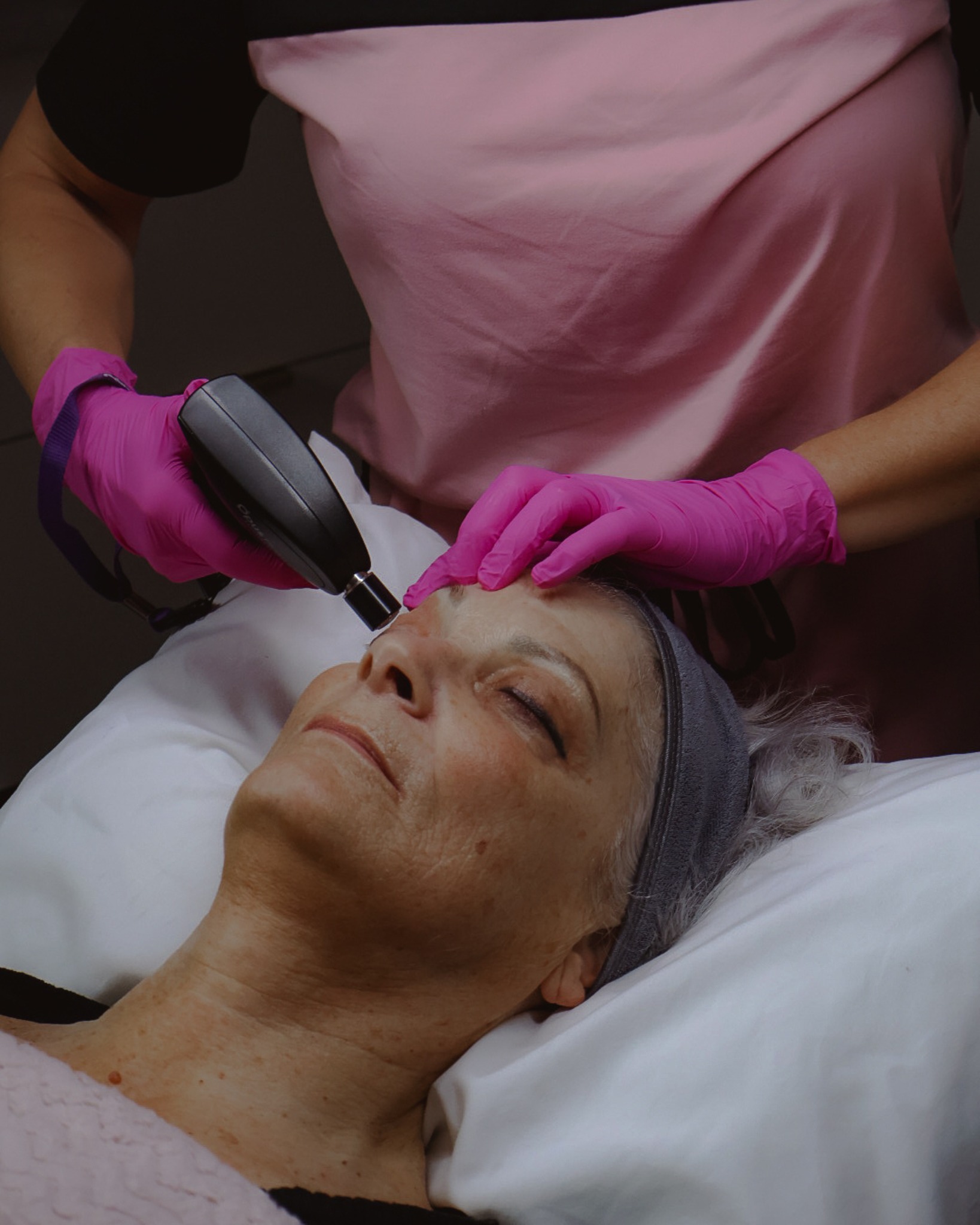 Hooded eyes are the question we see everywhere. 👀
And the honest answer is: it depends on what’s causing the hooding.
Some concerns are mostly anatomy. Some are skin laxity. Some are brow position.
What we do in consult:
✨ assess lid shape + brow position
✨ check skin quality and laxity
✨ talk what’s realistic without surgery
✨ build a plan based on your face, not trends
If you want to know what’s realistic for you, book a free consultation and I will walk you through it.
—————
Smooth Secret RN 💋 It’s our Secret
Jo-Lynn Gibbs RN, BScN
#HoodedEyes #NonSurgicalEyeLift #SherwoodParkAesthetics