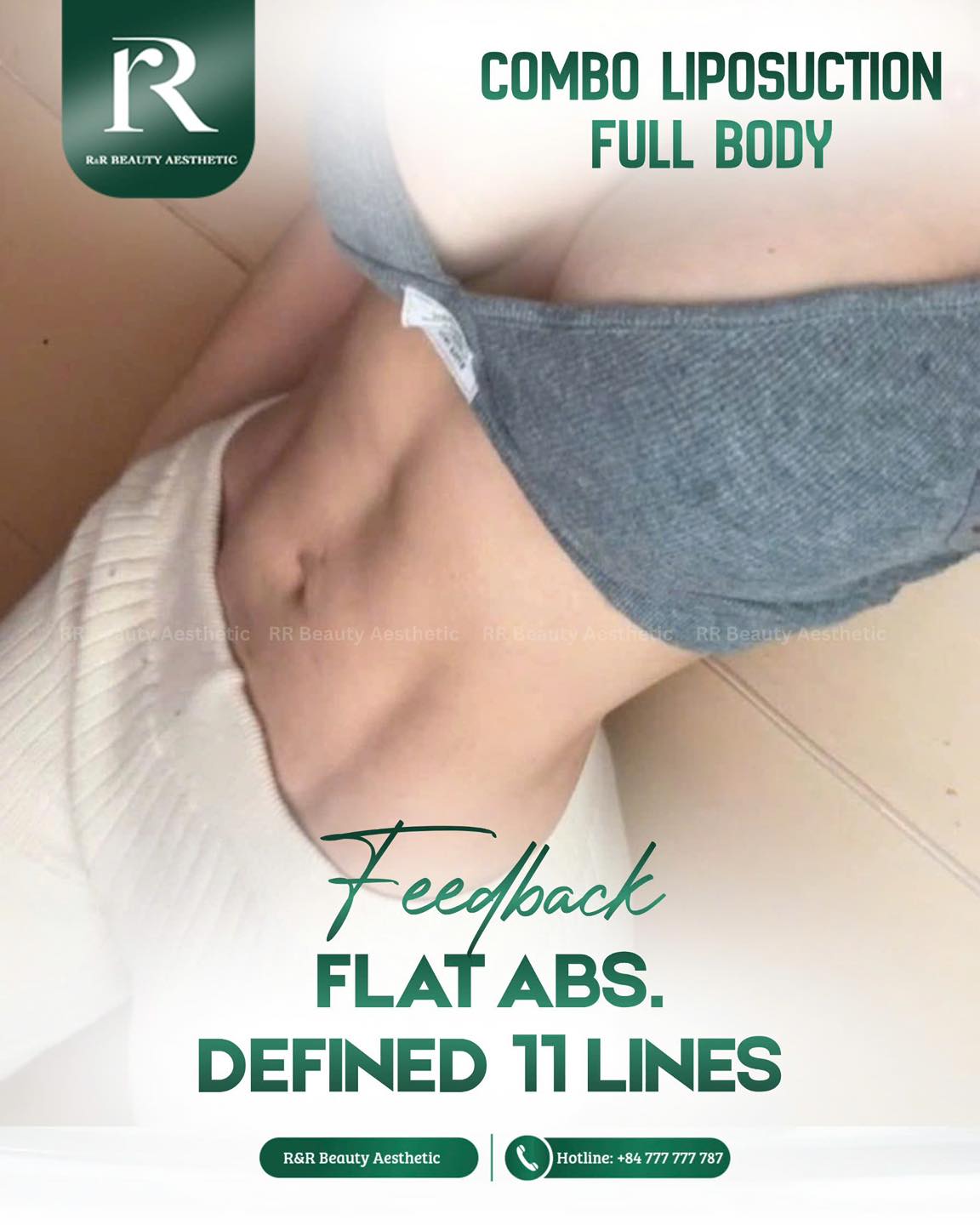✨ COMBO LIPOSUCTION FULL BODY (11-LINE ABS)
✔ Flat, sculpted abdomen with defined 11-line abs
✔ Slimmer waist and more defined body contour
✔ Eliminate stubborn belly fat that won’t go away with diet
✔ Enhance natural curves for a more feminine silhouette
✔ Visible results in fitted outfits and every angle
🎁 FREE facial fat grafting for a more youthful glow
⚡ Message us now to achieve your 11-line abs.
.
.
.
#rrbeauty #liposuction #flatabs #11lineabs #bodycontouring
flat abs procedure 11 line abs liposuction waist slimming treatment abdominal contouring surgery body sculpting clinic aesthetic clinic near me before after abs