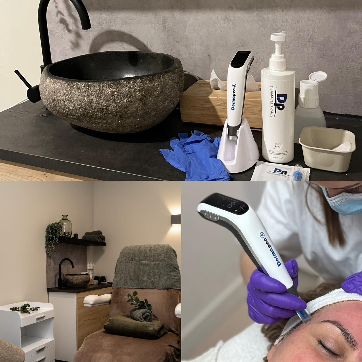 Het is het perfecte moment om een intensieve behandeling te boeken.
De uv-straling is nog niet heel hoog en het is makkelijker om je je huid goed te beschermen!
Met Microneedling, TCA Peeling,Biopeeling of een laserbehandeling zet je huid flink aan het werk.
Zo ga je stralend, strakker en met een mooie huid het voorjaar tegemoet!
Boek een behandeling in op:
www.schoonheidssalonwilmameins.nl