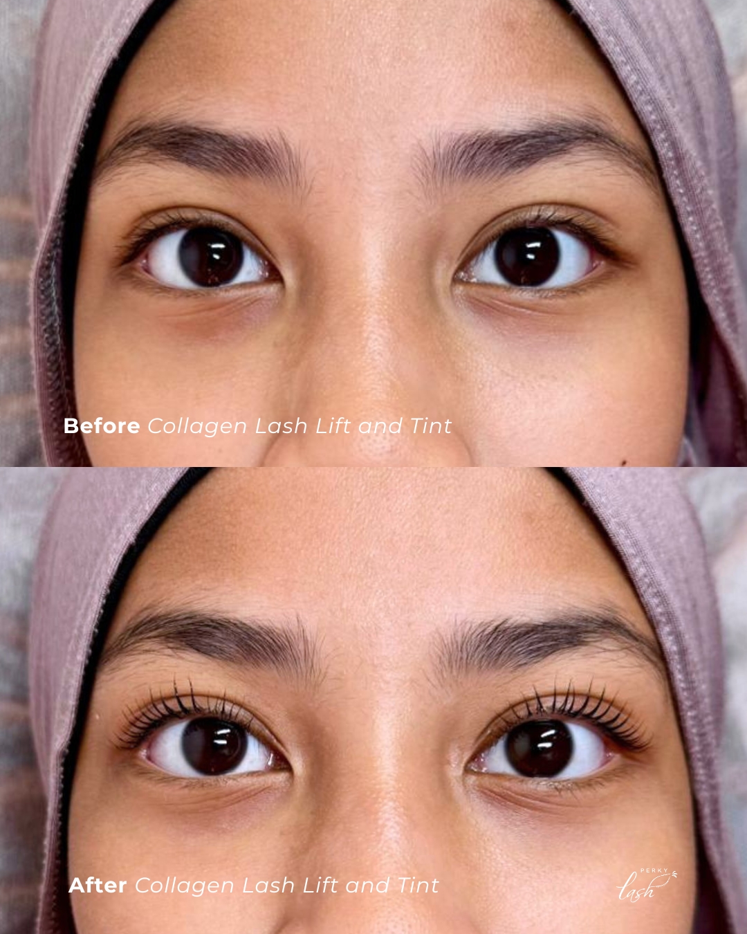 Look at that lift ๐โคโค
Our Collagen Lash Lift and Tint gives you this natural lift which last for 4-6 weeks!
With a keratin tint, you're not just lifting your lashes, but also infusing Keratin, Collagen for healthy lashes!
๐ฒ +65 83185222
๐ Serangoon NEX | Tampines One | One Raffles Place