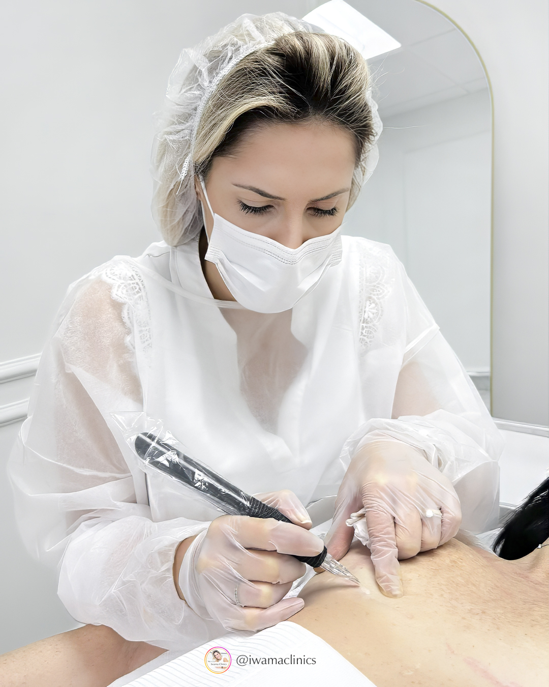 When @priscilaiwama created the Iwama Sensitive Technique, it wasn’t to follow a trend.
It was to solve a real problem: results that look good at first,
but require constant maintenance or leave the skin paying the price later.
Iwama Sensitive is a gentle, precision-based approach designed to respect the skin’s biology.
That’s why it can be used on sensitive skin and restorative cases, including scars and tone irregularities,
with the level of care that protects the skin long-term.
The goal is never “more.”
It’s less maintenance.
Less covering.
Less thinking about one detail every day.
Natural results that settle softly over time
and still look like you in every light.
With care,
Iwama Clinics
#medicaldermopigmentation #scarrevision #scarremoval #dermopigmentation #clinicmedicaldermopigmentation