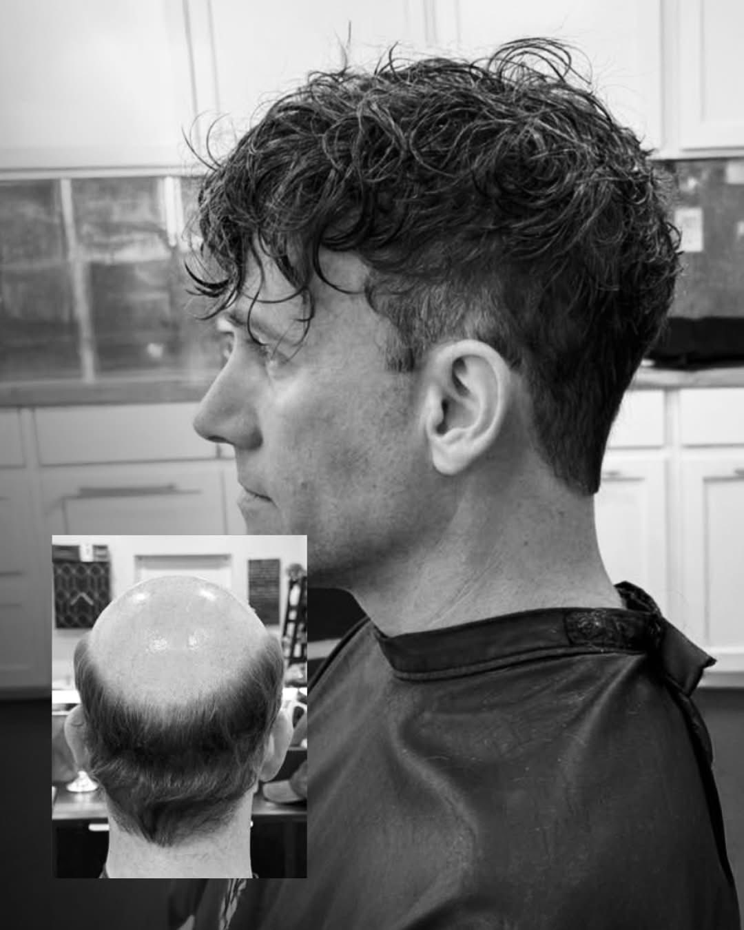 Passez le cap, reprenez le contrôle de votre look!
#byTun #bytunshop
#AvantAprès #ChuteDeCheveux #ConfianceEnSoi #LookNaturel #hairskeen