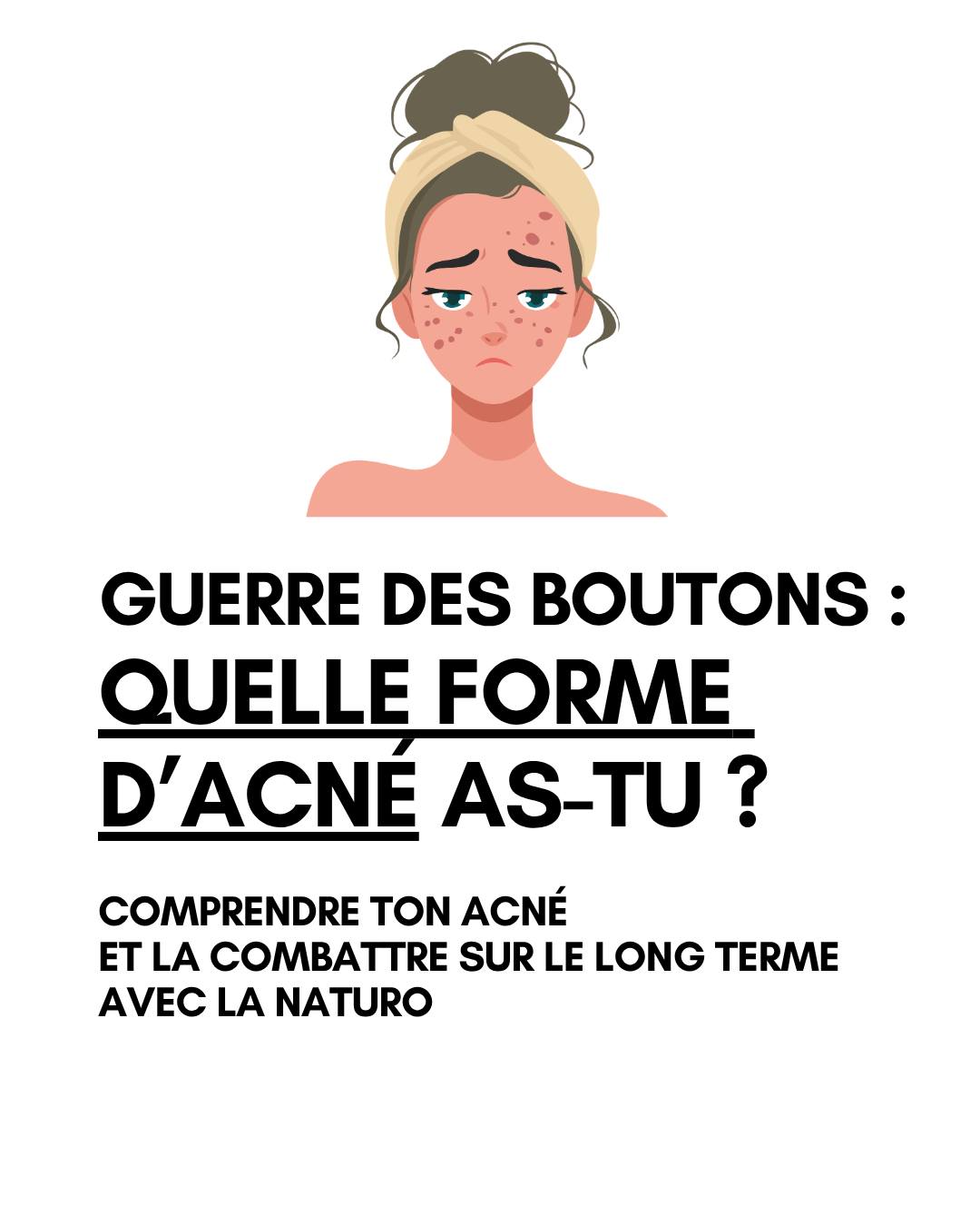 âš Et si ton acnĂ© nâĂ©tait pas un simple problĂšme de peau ?
Chez la femme, lâacnĂ© est souvent le reflet dâun dĂ©sĂ©quilibre plus profond : hormones, inflammation, stress, microbiote⊠đż
đ« AcnĂ© hormonale â bas du visage, cycles, rĂšgles
đ„ AcnĂ© inflammatoire â boutons rouges, douloureux
â« AcnĂ© rĂ©tentionnelle â points noirs, peau irrĂ©guliĂšre
đ„ AcnĂ© kystique â profonde, cicatricielle
đ Ce que ta peau essaie de te dire :
⹠ton alimentation influence ton équilibre hormonal
⹠ton intestin joue un rÎle clé
âą ton stress nourrit lâinflammation
đ± Les vrais leviers :
âïž une alimentation Ă IG bas
âïž du zinc + omĂ©ga-3
âïž un foie soutenu (hello chardon-marie đż)
âïž des plantes adaptĂ©es (gattilier, bardaneâŠ)
đ On ne âcombatâ pas lâacné⊠on rééquilibre le terrain.
Et toi, ton acnĂ© ressemble Ă laquelle ? đ
www.naturopathierennes.com >>> Retrouve mon dernier livre "PEAU SOUS PRESSION" Libérer tes émotions pour soulager ta peau.
Pour prendre RDV avec moi : PLANITY
â
Visio ou cabinet Ă Rennes
â
Bilans de naturopathie avec programme personnalisé
â
Bilans nutrition et micro-nutrition
â
Massages, drainages, réflexologie plantaire
#acne #peau #skincare #problemedepeau #naturopathierennes
