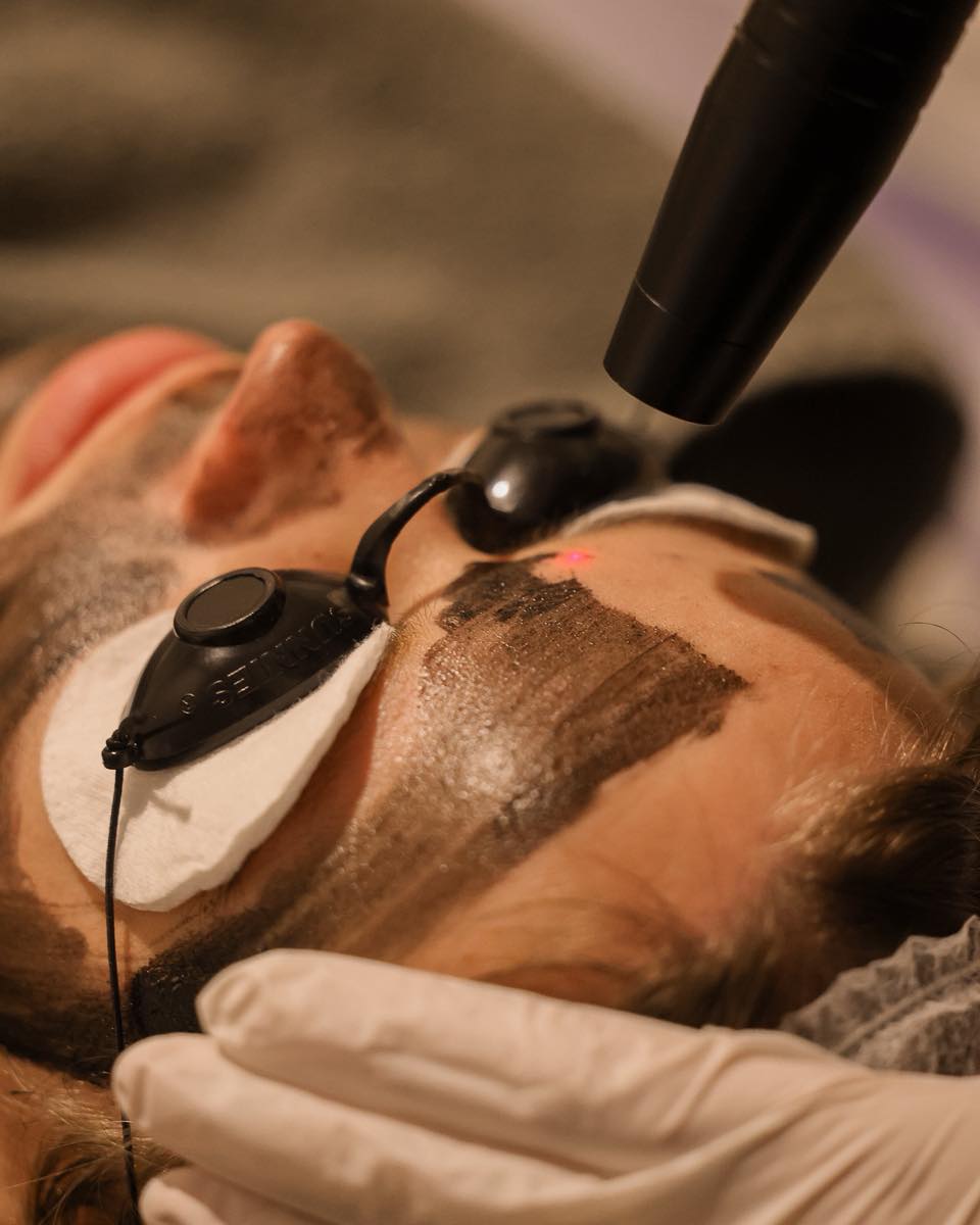 Wil jij ook een prachtige glow?!!
Boek een Carbonpeeling met onze Picolaser!
* veilig en zeer effectief
* meteen een prachtige glow
* geen pijn of beschadigingen/roodheid nadien
* stimulatie van collageen en elastine
* minder lijntjes en rimpels
* egalere huid en fijnere poriën.
Boek de Carbonpeeling op:
www.schoonheidssalonwilmameins.nl
#schoonheidssalonwilmameins #centrumveendam #carbonpeeli̇ng #langmairpicolaser #glowskin #liefzijnvoorjezelf