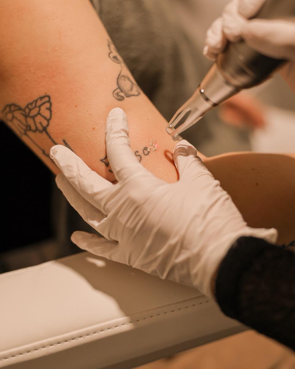 Heb jij ook spijt van je tattoo?
Vaak kunnen wij je helpen om met onze Picolaser de tatoeage veilig en effectief te verwijderen.
Maak een afspraak voor een gratis en vrijblijvend intakegesprek en een proefbehandeling.
www.schoonheidssalonwilmameins.nl
#schoonheidssalonwilmameins #centrumveendam #venvanveendam #langmairpicolaser #veiligverwijderenvantatoeages