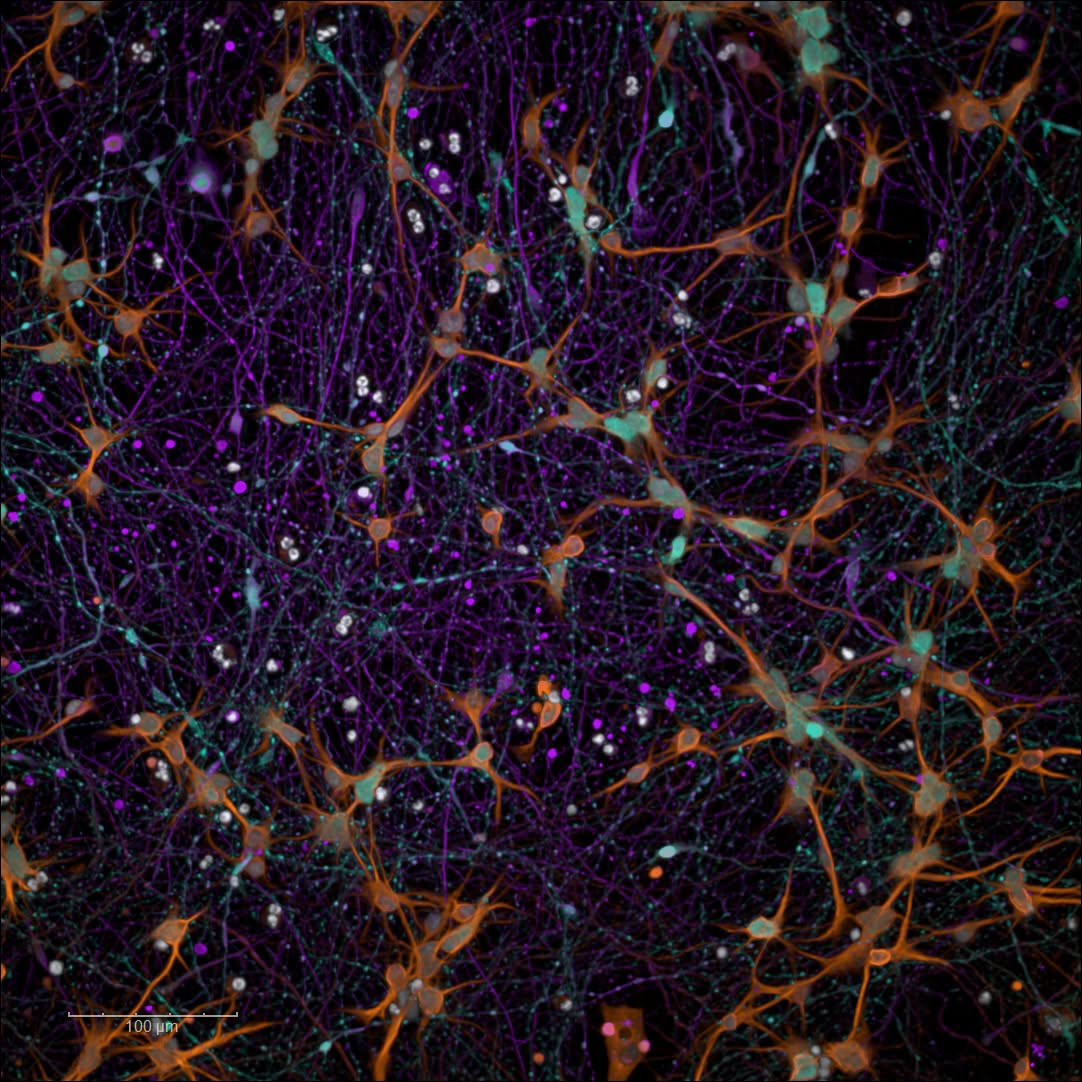 Meet our 2 weeks cortical neurons. 🔬💙 From our isogenic control line because good science starts with the right controls. Nuclei glowing in white (Hoechst), dendrites reaching out in orange (MAP2), early neurons branching in magenta (TUJ1) and Inhibitory cells shining in cyan (GABA). #Neuroscience #CellBiology #StemCells #CorticalNeurons #Fluorescence #LabLife #BrainResearch #iPSC