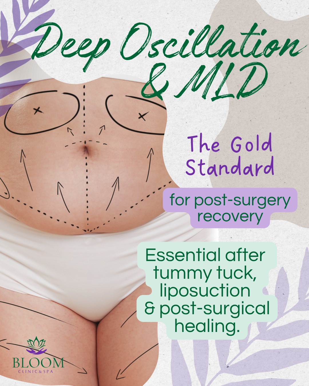 Hi there, lovely ladies 🌸
Post-surgery swelling can feel incredibly heavy and uncomfortable. It’s frustrating when your body feels tight and "stuck" during recovery.
I use Deep Oscillation to help:
🌸 Flush stubborn fluid.
🌸 Soften internal scarring.
🌸 Speed up medical healing.
You deserve a gentle, expert recovery. I’m here to help you feel light again. 🤍
DM to book today.