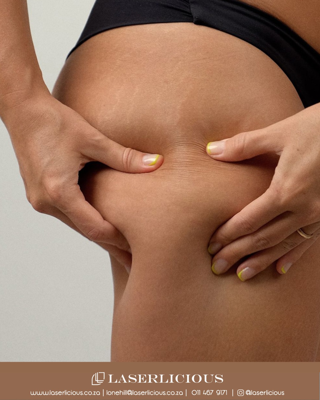 Dieting. Training. Still not seeing results in certain areas?
That’s where fat freezing comes in.
CoolTech Cryolipolysis works beneath the surface to eliminate stubborn fat cells - helping you achieve a more sculpted, defined look without surgery or downtime.
Target what’s bothering you. See real change.
📞 Call Laserlicious on 011 467 9171 / WhatsApp 083 490 9524 / info@laserlicious.co.za to make a booking today.