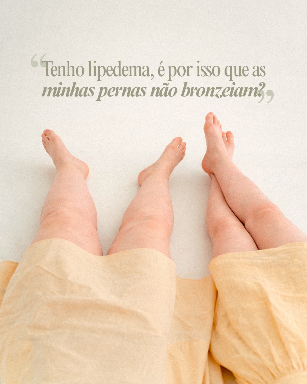 O tempo mais quente está a chegar e esta é uma pergunta frequente em consulta. A verdade é que sim, as pernas com lipedema têm mais dificuldade em bronzear, devido a vários fatores que pode conhecer no nosso carrossel de hoje. No programa lipedema apresentamos estratégias que podem ajudar a "dar a volta" a esta questão, para que se sinta melhor e com mais autoestima. ✨
*Conteúdo informativo, em respeito pelas normas éticas e deontológicas. Os resultados variam de pessoa para pessoa. Não dispensa a consulta médica para uma análise personalizada.
Dra. Catarina Santos | OM 54345
#clinicametamorfose #dracatarinasantos #medicinaestetica