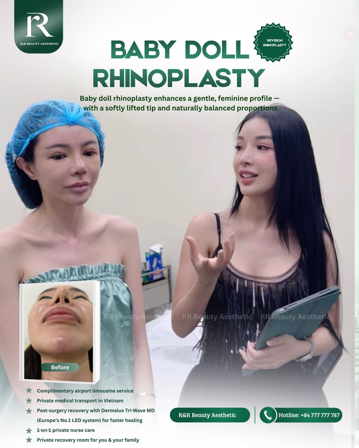 Baby Doll - Rhinoplasty:
✨ A softly lifted, naturally curved nose bridge
✨ A refined, slightly upturned tip for a youthful look
✨ Better nostril symmetry and balanced proportions
✨ A smoother, more harmonious facial profile
From every corner, the nose looks softer, more refined, and perfectly proportioned.
DM to get your personalized consultation today
.
.
.
#babydollnose #rhinoplasty #naturalresults #facialharmony #aestheticclinic
baby doll rhinoplasty natural nose job soft nose shape nose tip lift facial harmony aesthetic clinic nose contouring before after natural results feminine look nose shaping beauty transformation confidence glow up