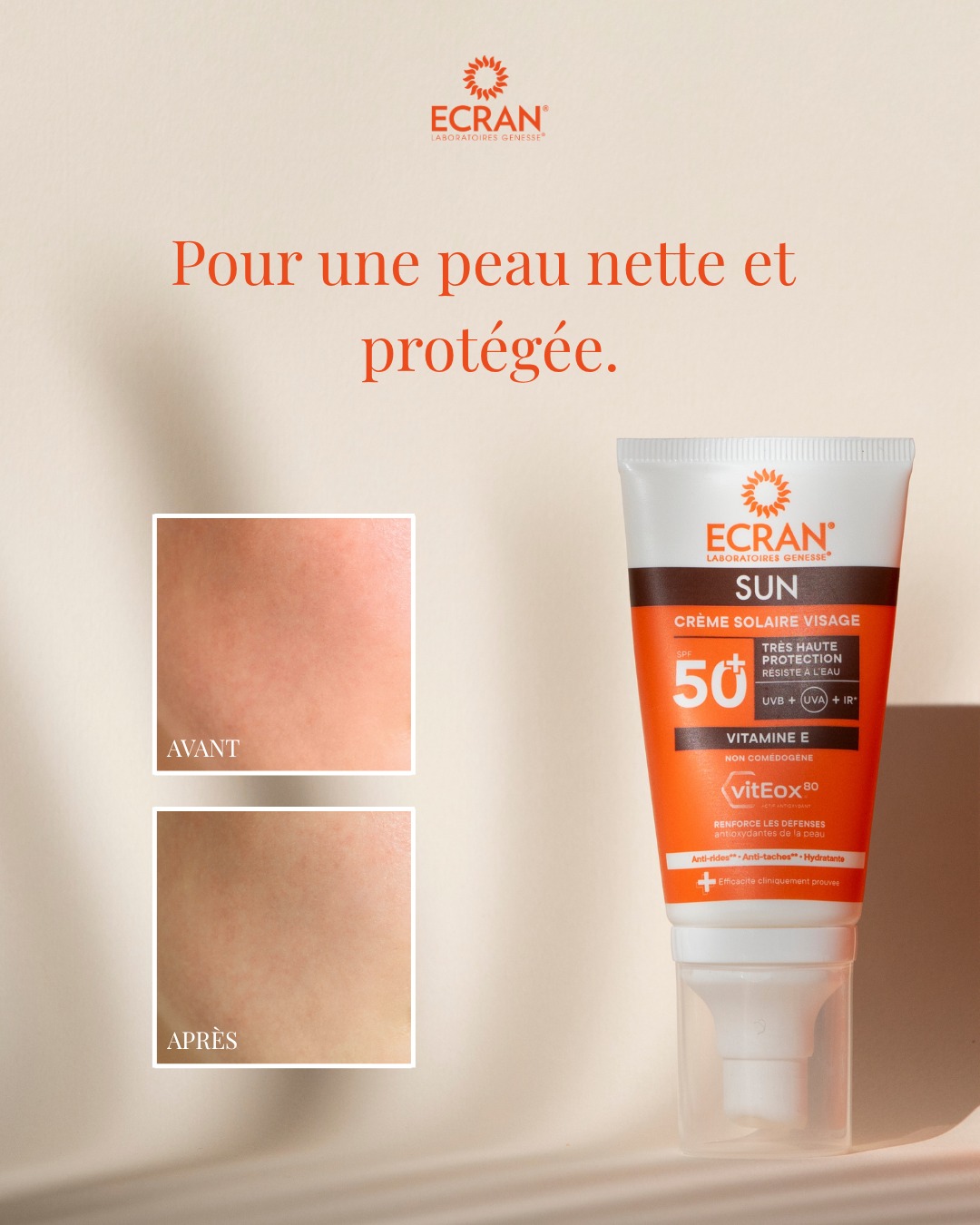Avant / après : et si la différence se voyait vraiment ?
Une peau fragilisée, marquée, en manque d’éclat… vs une peau protégée, lumineuse et visiblement plus saine 💛
La clé ? une protection quotidienne adaptée qui agit jour après jour
Avec ecran SPF50+, votre peau est protégée des UVA, UVB et agressions extérieures pour préserver tout son éclat !
#protectionuv #spf #preventionsolaire