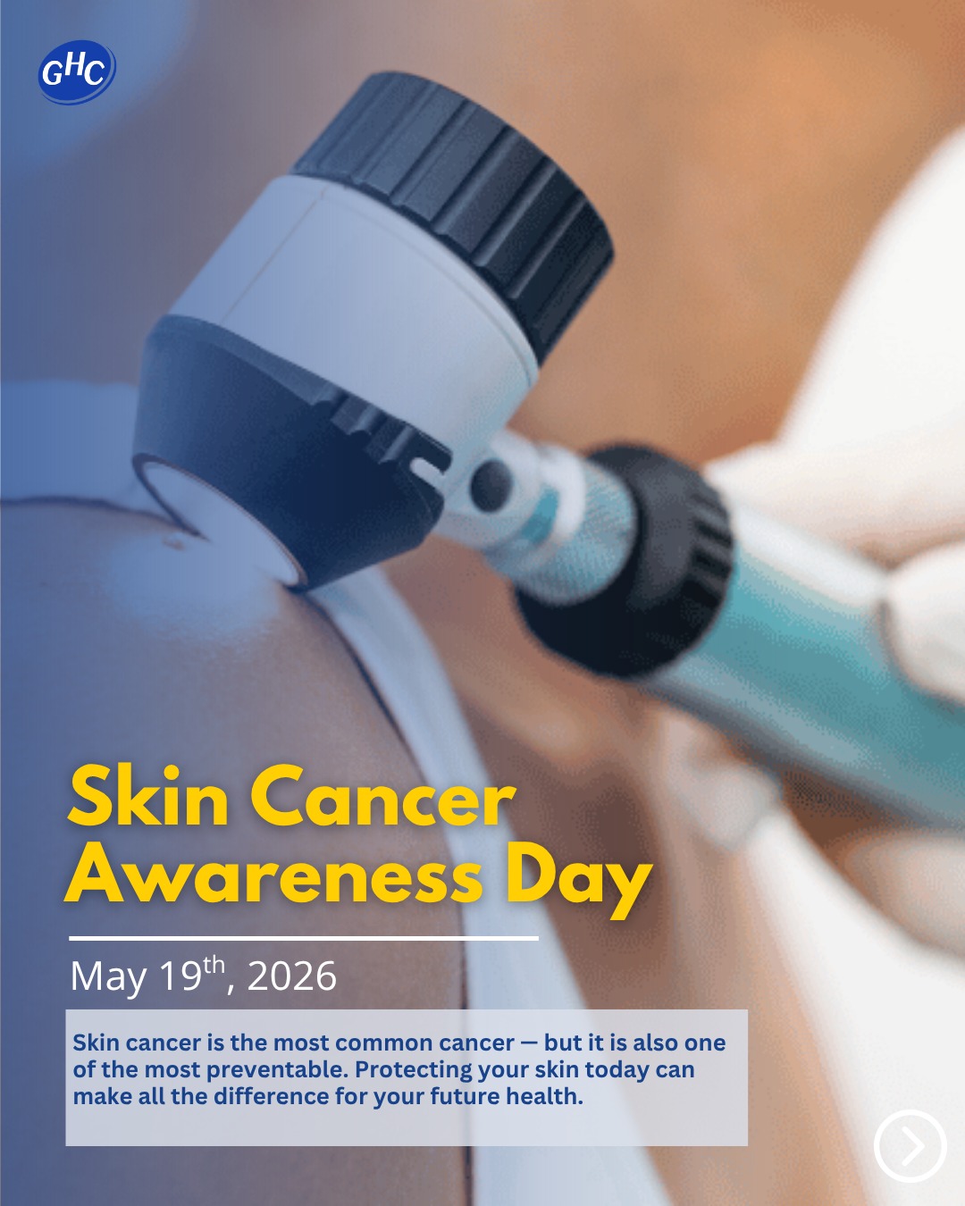 Skin cancer is one of the most common types of cancer, but early detection and protection can make a major difference. Wearing sunscreen, limiting excessive sun exposure, and scheduling regular skin checks are simple ways to help protect your health!
#healthcenter #communitywork #communityclinic #mentalhealth #chiropractor #pediatric #obgyn #optometry #familydoctor #sgv #sangabrielvalely #montereypark #losangeles #rosemead #healthcare #doctor #nonprofit #garfieldhealthcenter #ghc #GarfieldHealthCenter #SkinCancerAwareness #SunSafety #ProtectYourSkin #EarlyDetection