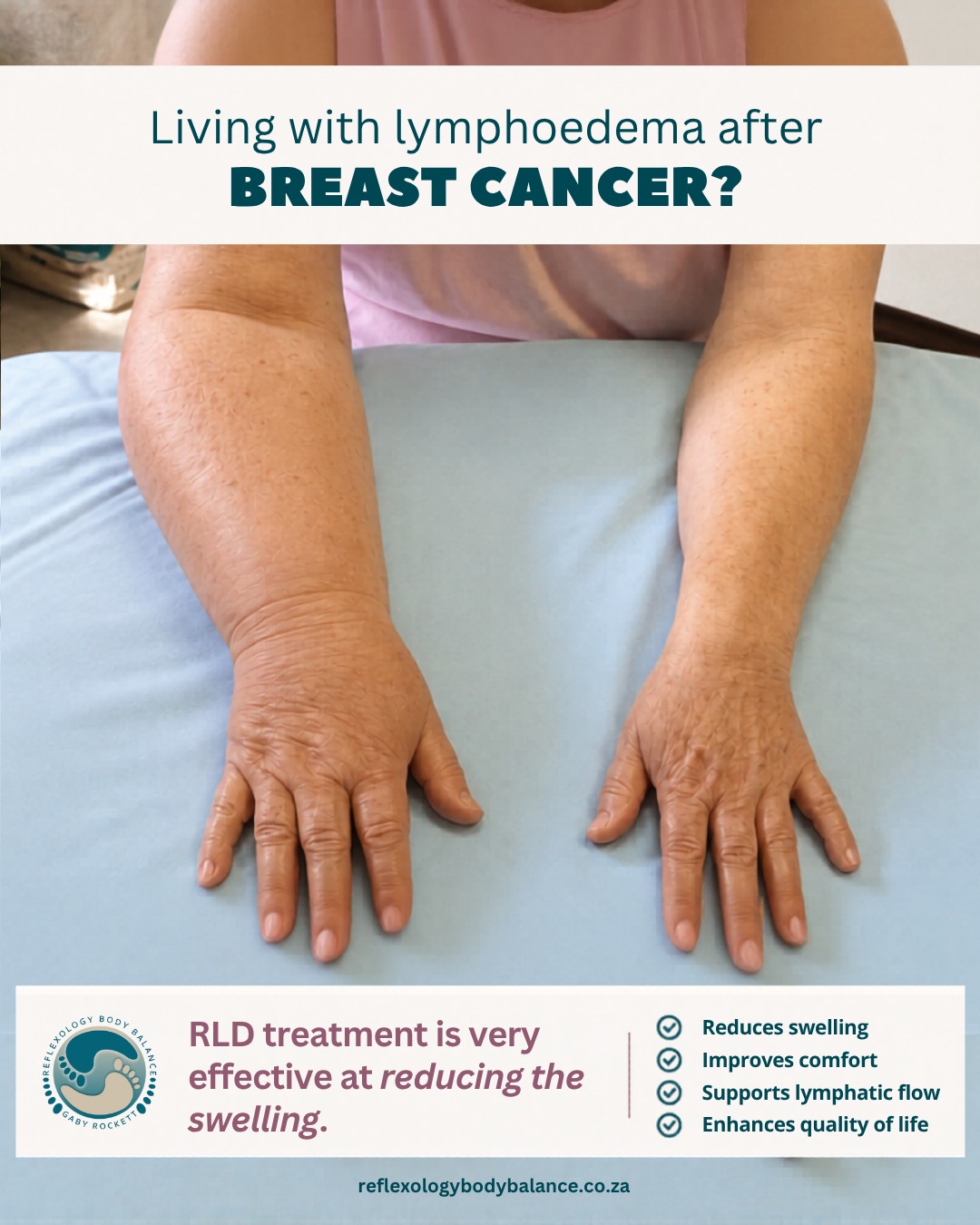 Secondary lymphoedema can develop following breast cancer treatment due to damage to the lymphatic system.
This may happen after procedures such as surgery, chemotherapy, radiotherapy, or lymph node removal.
For many women, the swelling can affect far more than just the arm — impacting comfort, movement, confidence, and emotional wellbeing.
RLD (Reflexology Lymphatic Drainage) treatment is a gentle technique designed to help encourage lymphatic flow, reduce swelling, and support overall comfort and quality of life. ✨
You are not alone, and support is available.
Reflexology Body Balance
Relax • Restore • Balance
www.reflexologybodybalance.co.za
#reflexology #reflexologymassage #reflexologytreatment #breastcancer #lymphoedema