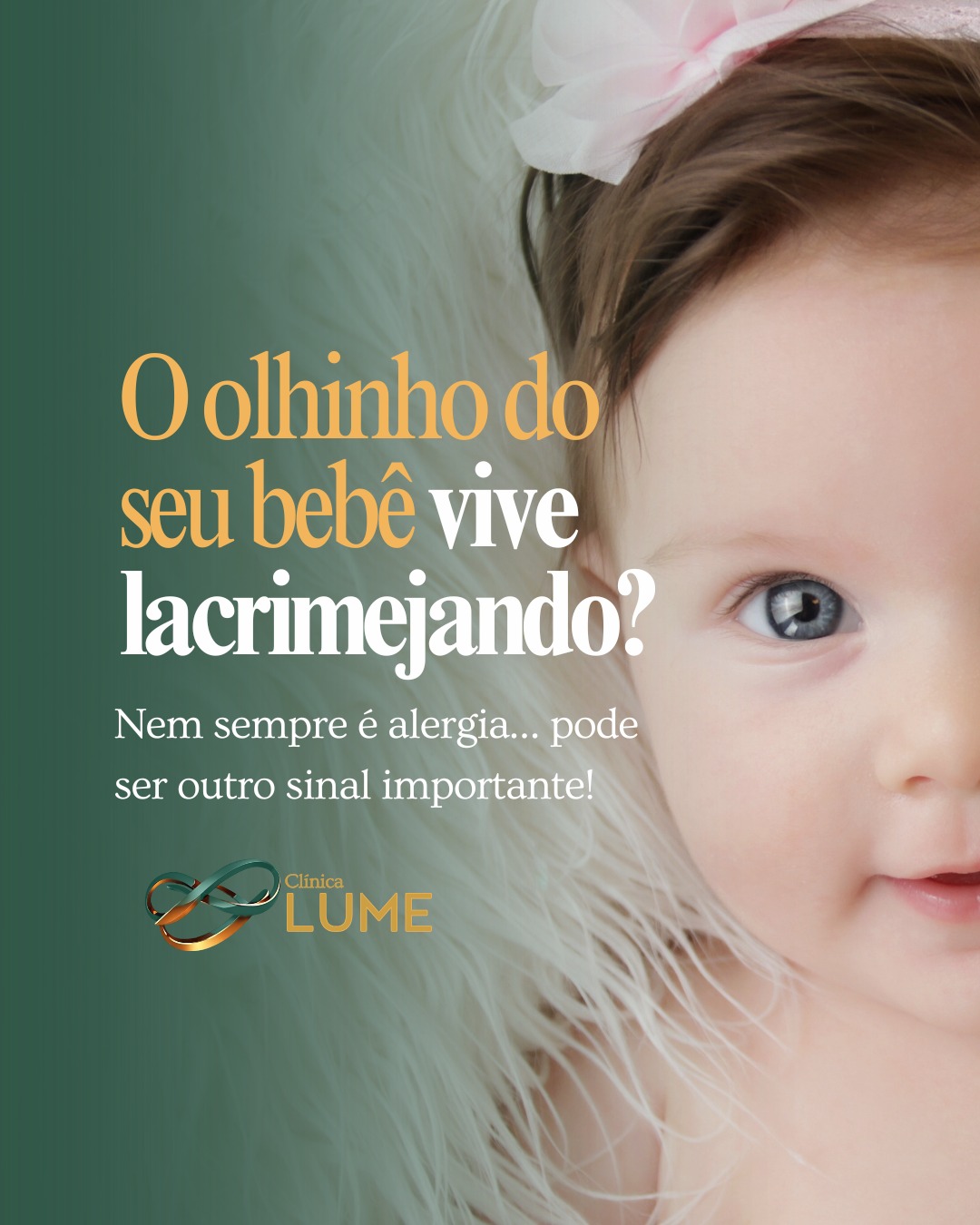 Quando o olhinho permanece constantemente úmido, mesmo sem choro, é importante investigar. Em muitos casos, pode haver alteração nas vias lacrimais — algo comum na infância, mas que frequentemente passa despercebido.
Com o tempo, o quadro pode evoluir com secreção recorrente, irritação e desconforto para a criança.
Por isso, observar os sinais desde cedo faz toda a diferença. ✨
A avaliação com uma oftalmopediatra é essencial para identificar a causa correta e indicar o melhor acompanhamento.
Na Lume, a oftalmopediatra cuida da saúde ocular dos pequenos com atenção especializada, acolhimento e olhar cuidadoso para cada fase da infância. 💙