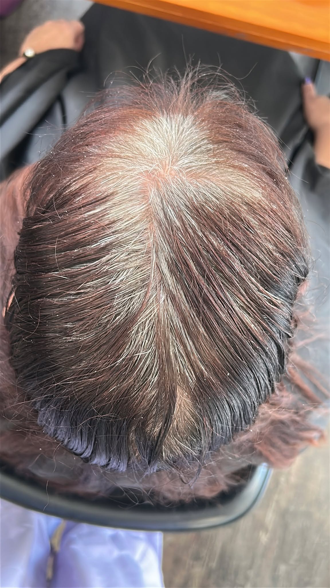 Say goodbye to the stubborn grey, and hello to multi-dimensional, vibrant color. ✨
Grey hair can be incredibly stubborn to lift and correct, but with the right placement and a lot of patience, we achieved this seamless, high-gloss transformation. Swipe through to see the journey from brassy and uneven to a beautifully blended, fresh finish.
If you're ready to correct your color and bring that brightness back to your hair, let’s make it happen.
Ready for your own transformation?
📥 DM us to chat about your hair goals
🔗 Visit fiolethair.com.au to secure your appointment
---
#FioletHair #PerthHairdresser #PerthSalon #ColorCorrection #GreyHairCorrection #PerthHair #HairTransformation #BehindTheChair
